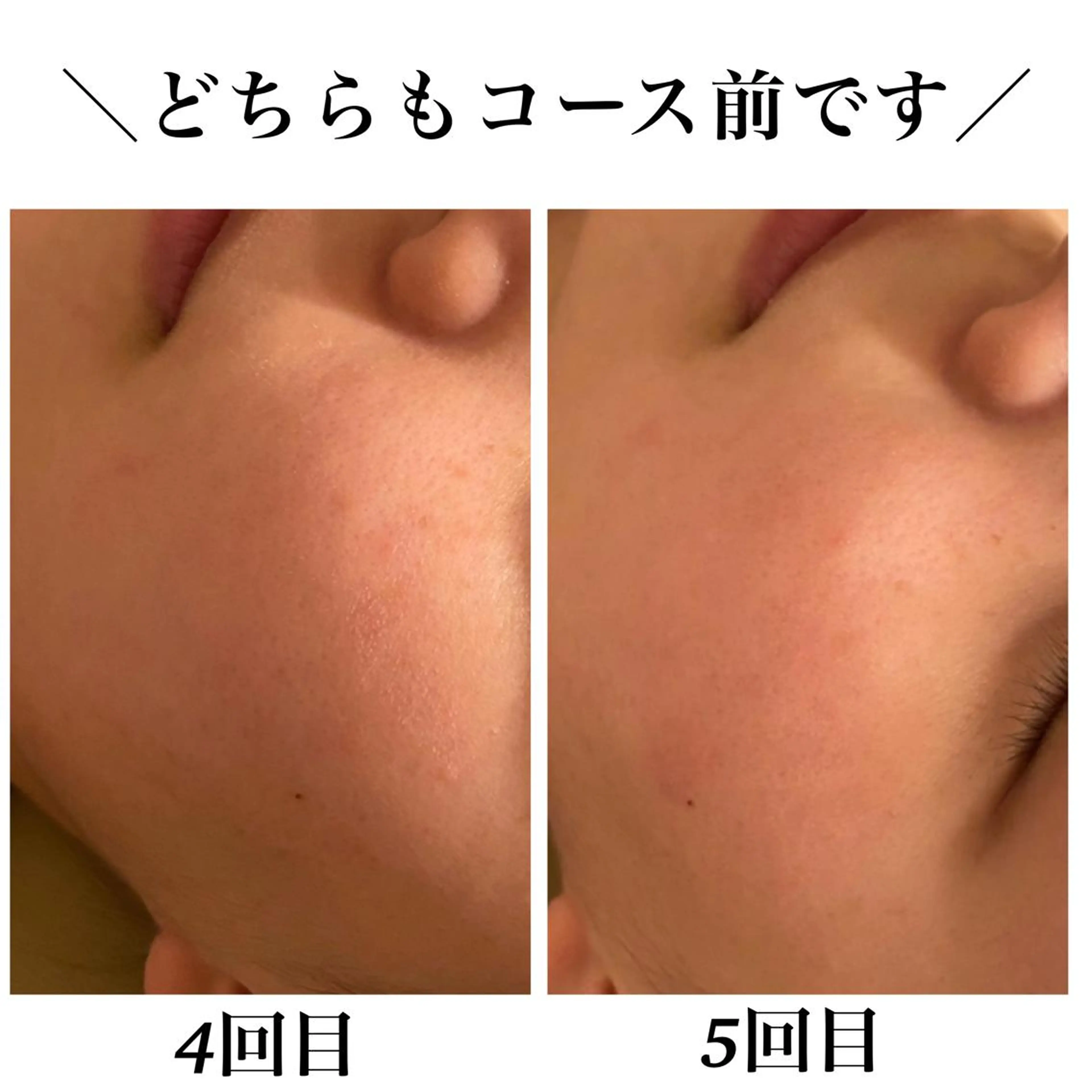 エステ リラク Bellesthe （ベルエステ）のエステ・リラクイメージ