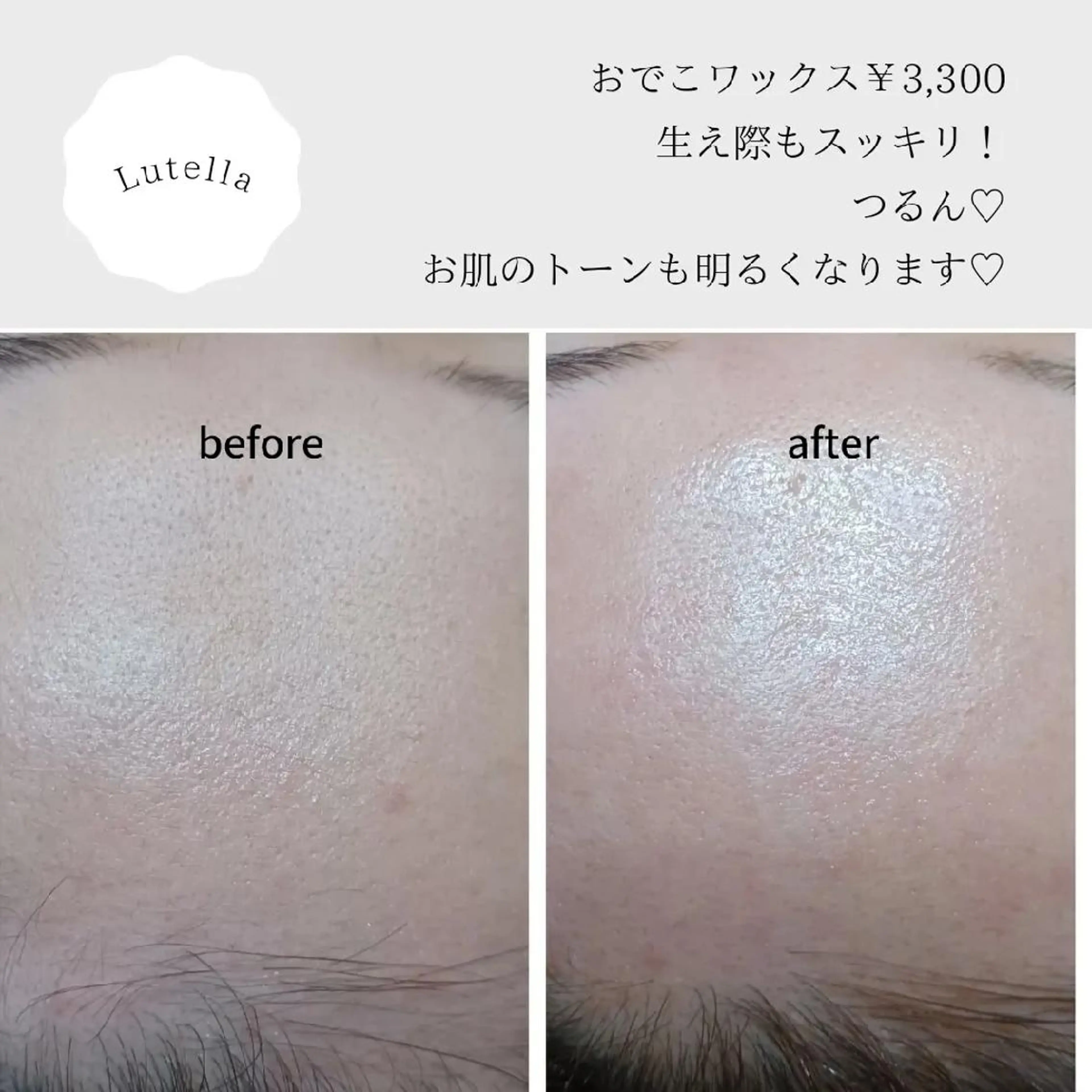 アイブロウ Lutella所属・ワックス脱毛専門店 Lutellaのエステ・リラクイメージ