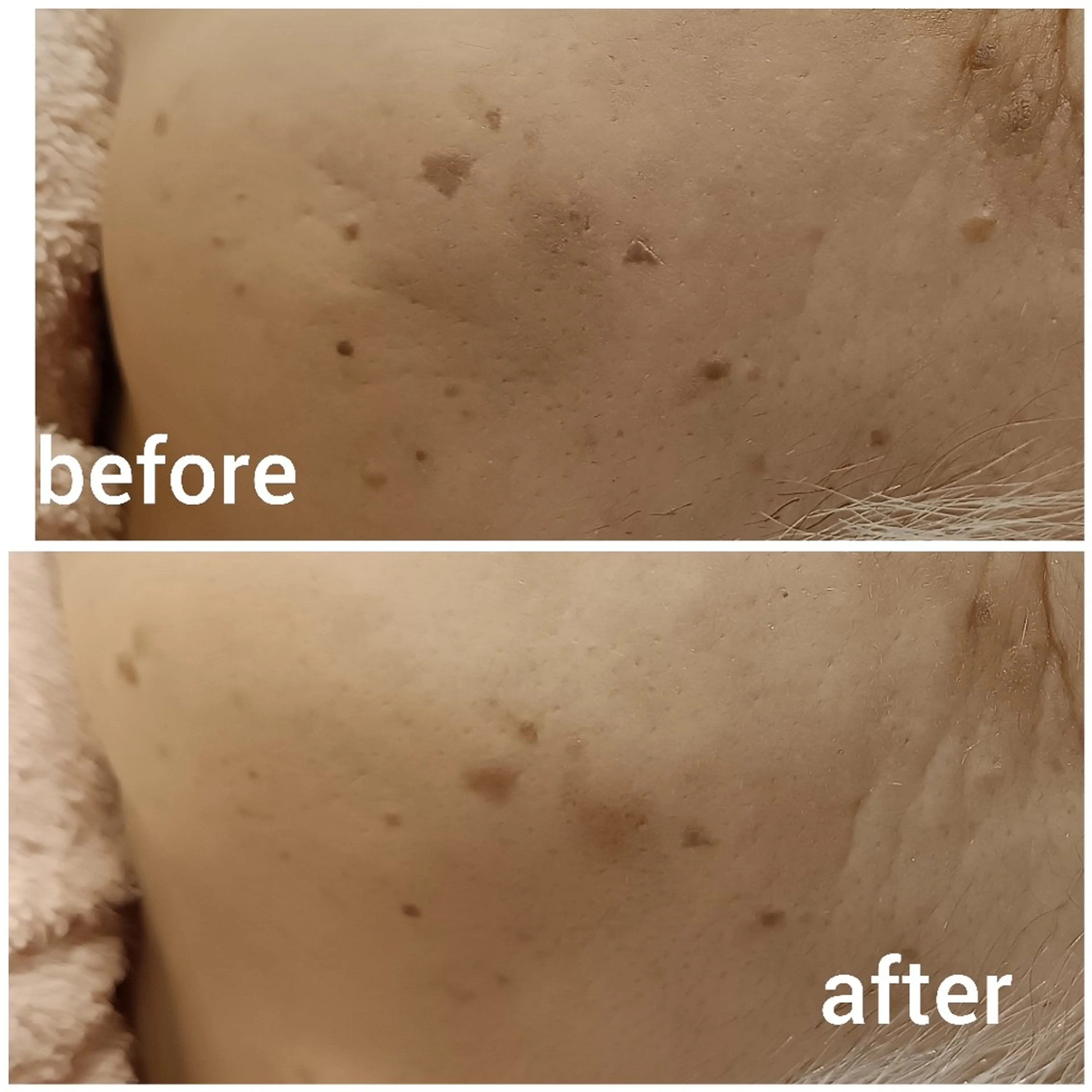 エステ フェイシャルエステ ZELOSSALONのエステ・リラクイメージ