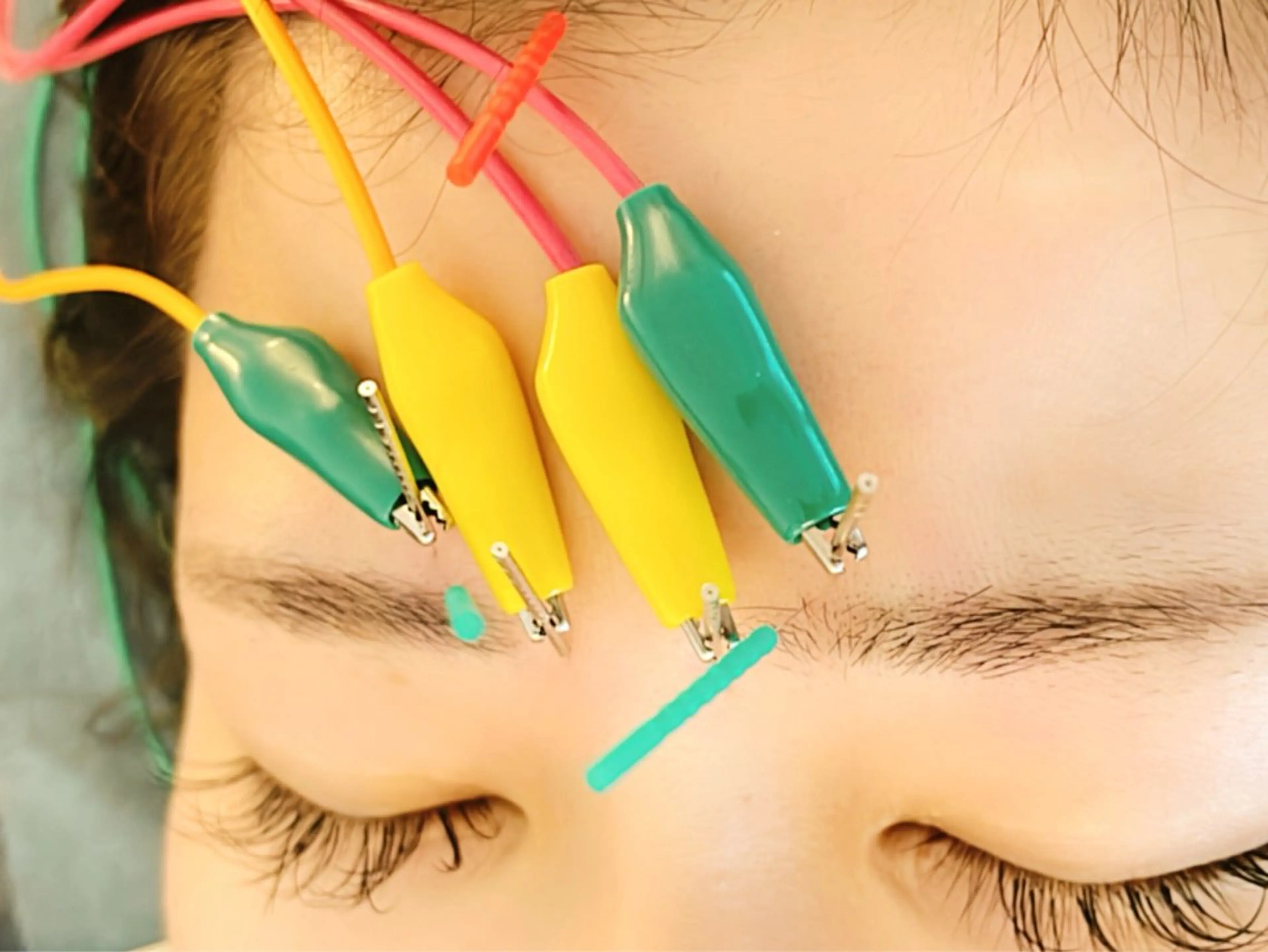 その他 小顔美容鍼専門サロン 渋谷YZのエステ・リラクイメージ