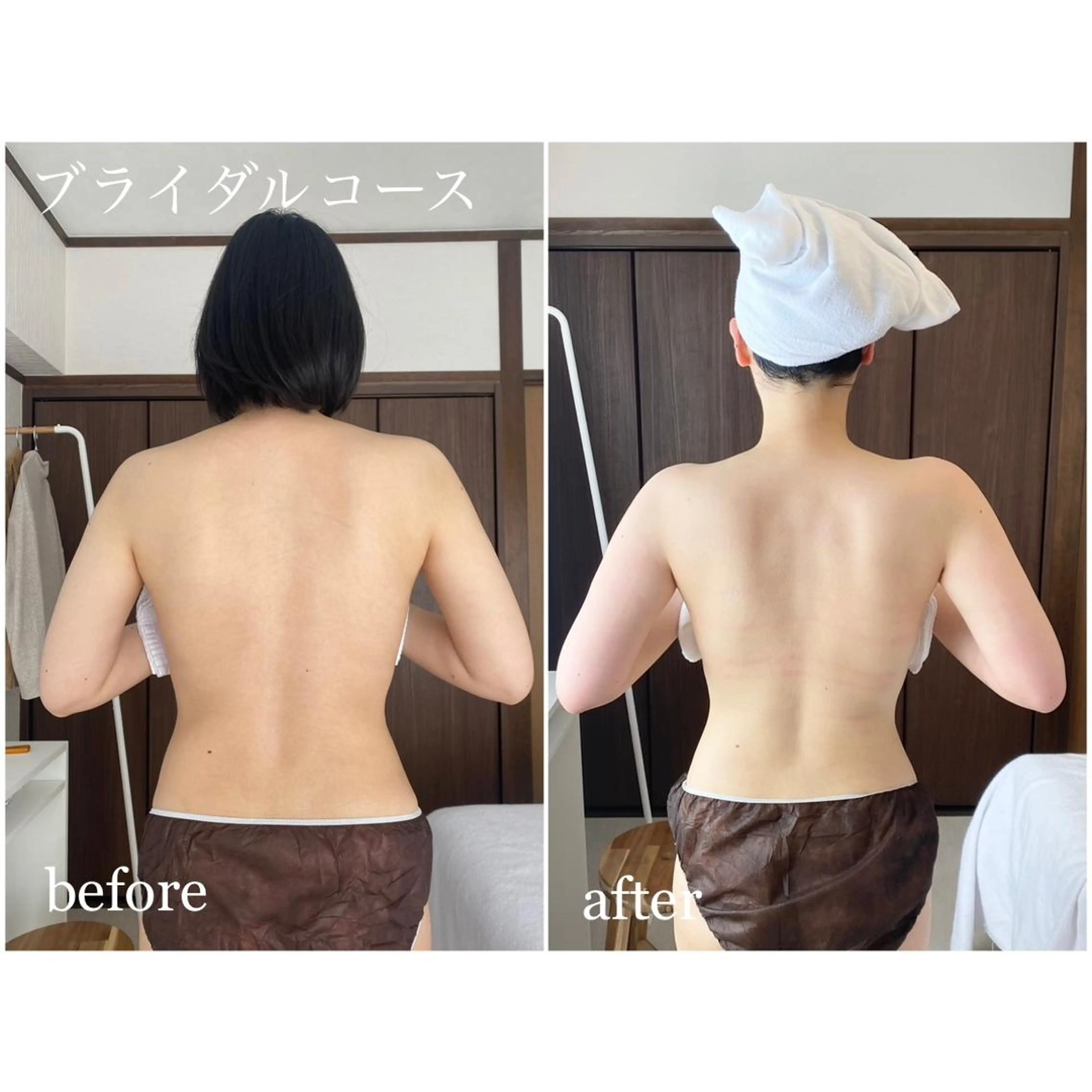 I'm -ｲﾑ-所属・肌質改善／ブライダル I'm.-イム-のエステ・リラクイメージ