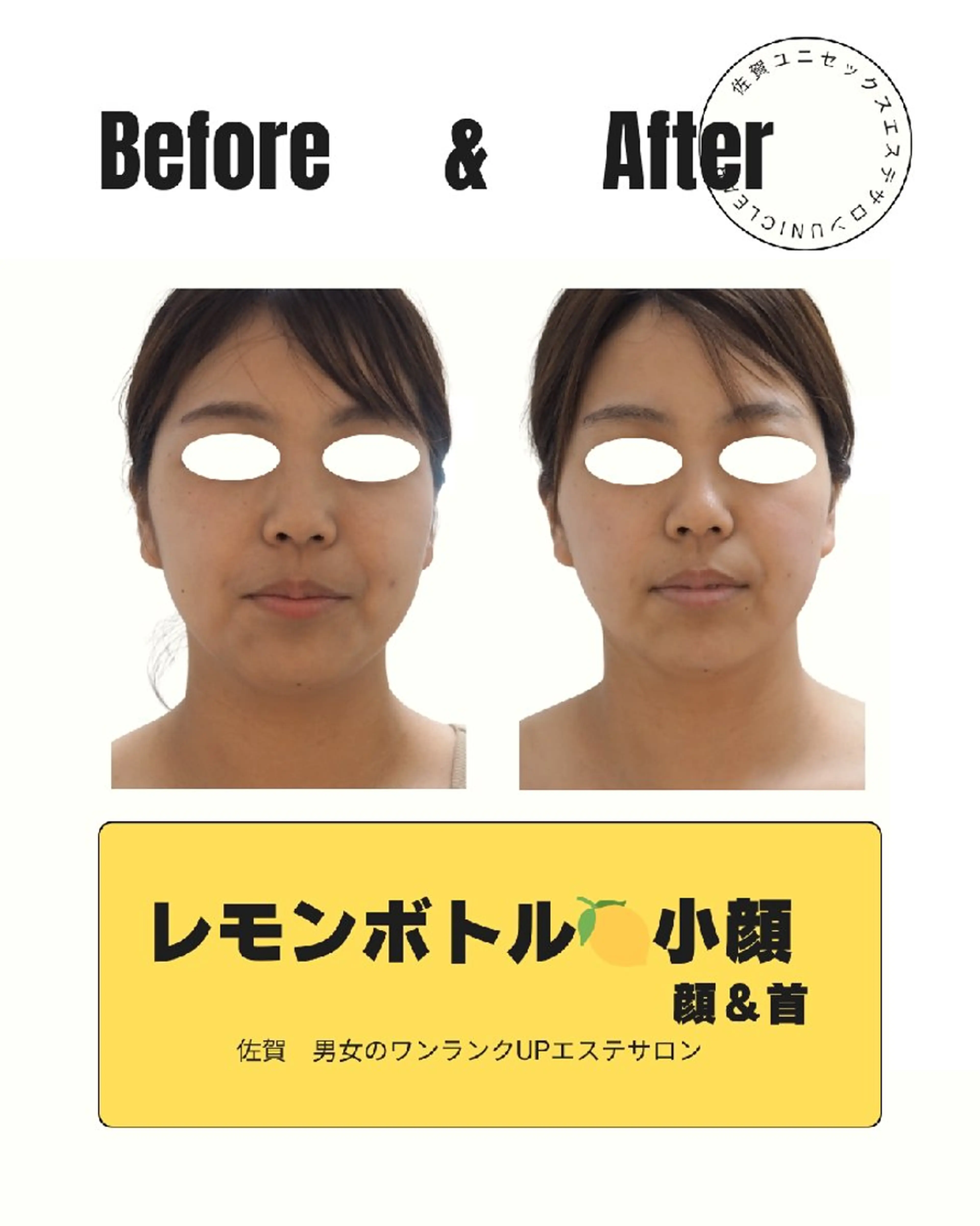 【今注目の小顔】レ モンボト ル小顔お試しの写真