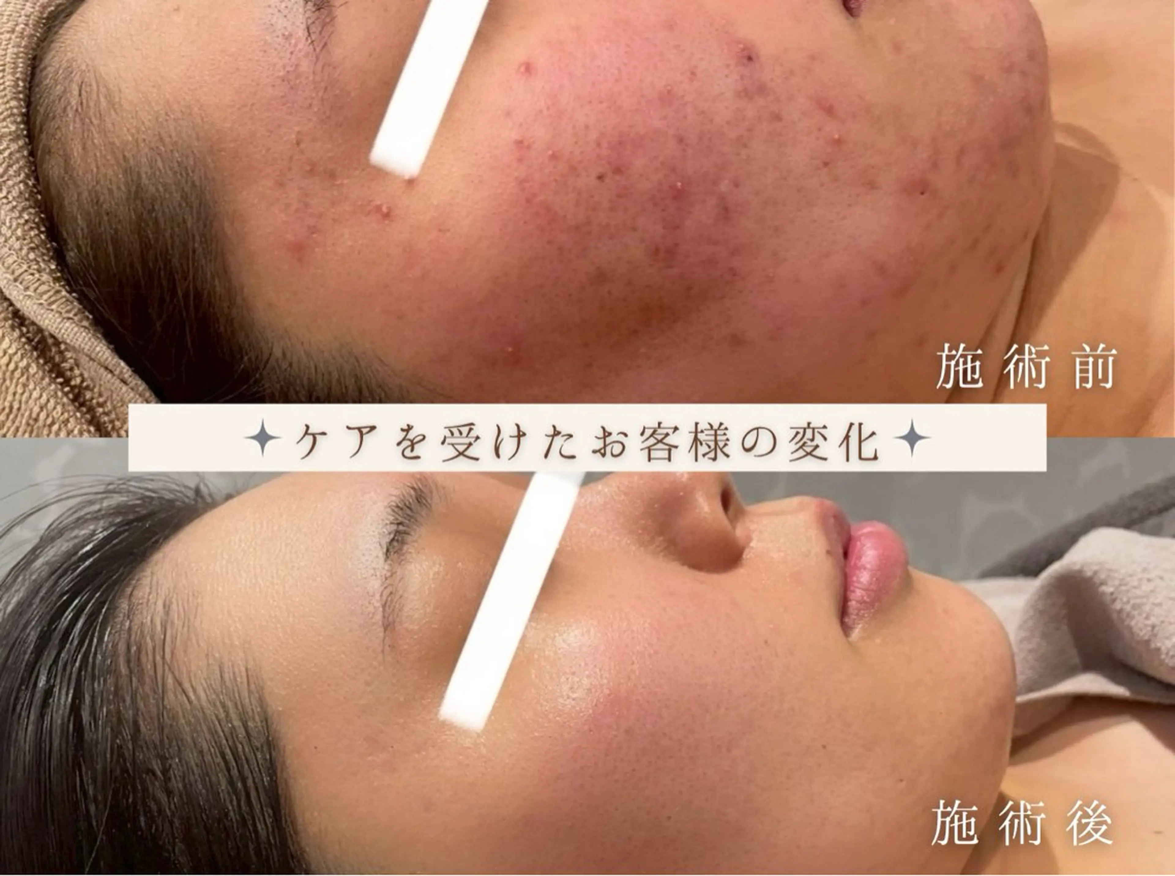 Anpawman所属・Anpawman アンパウマンのエステ・リラクイメージ