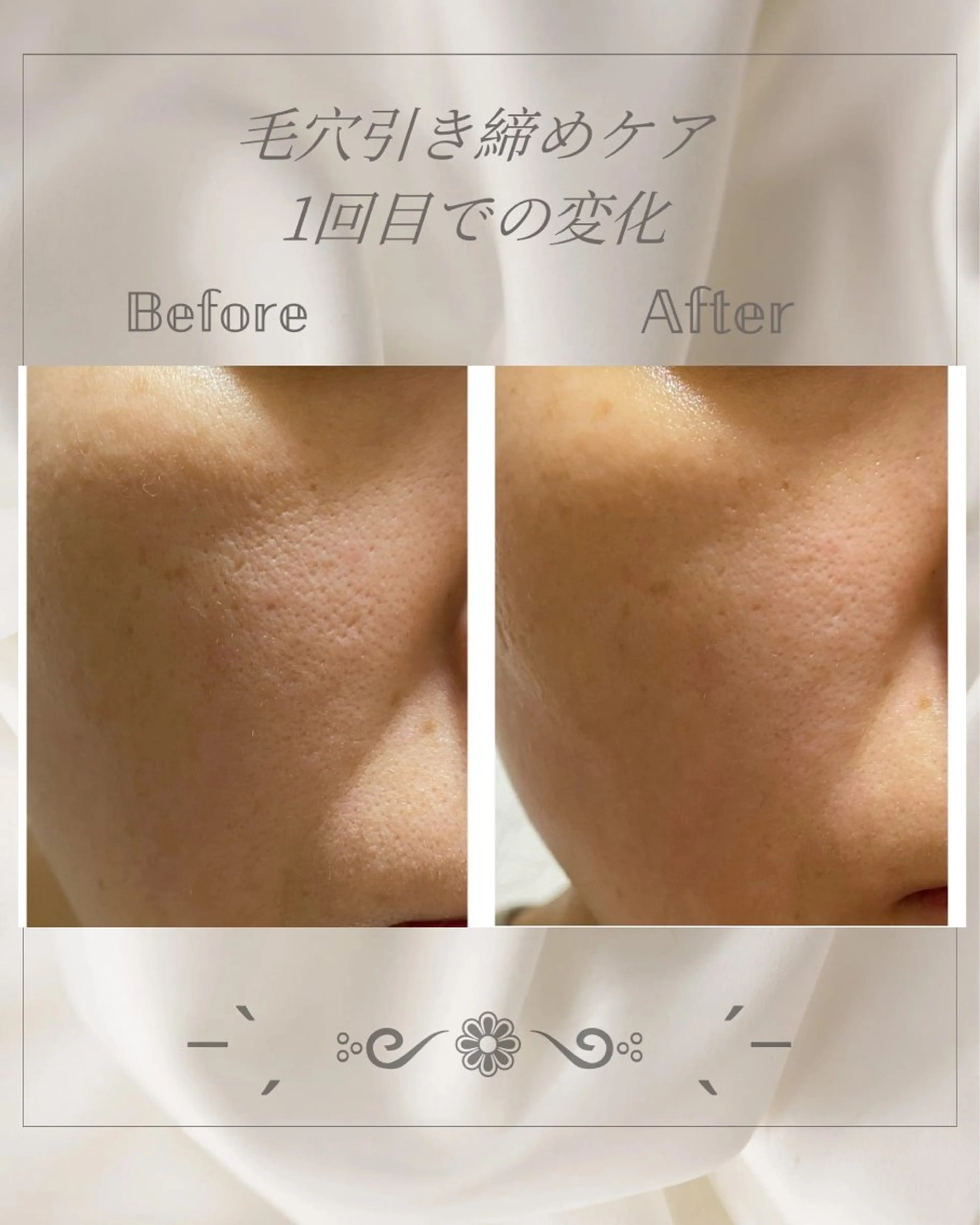 エステ Aesthetic Salon Hauoli所属・エステティックサロン ハウオリのエステ・リラクイメージ