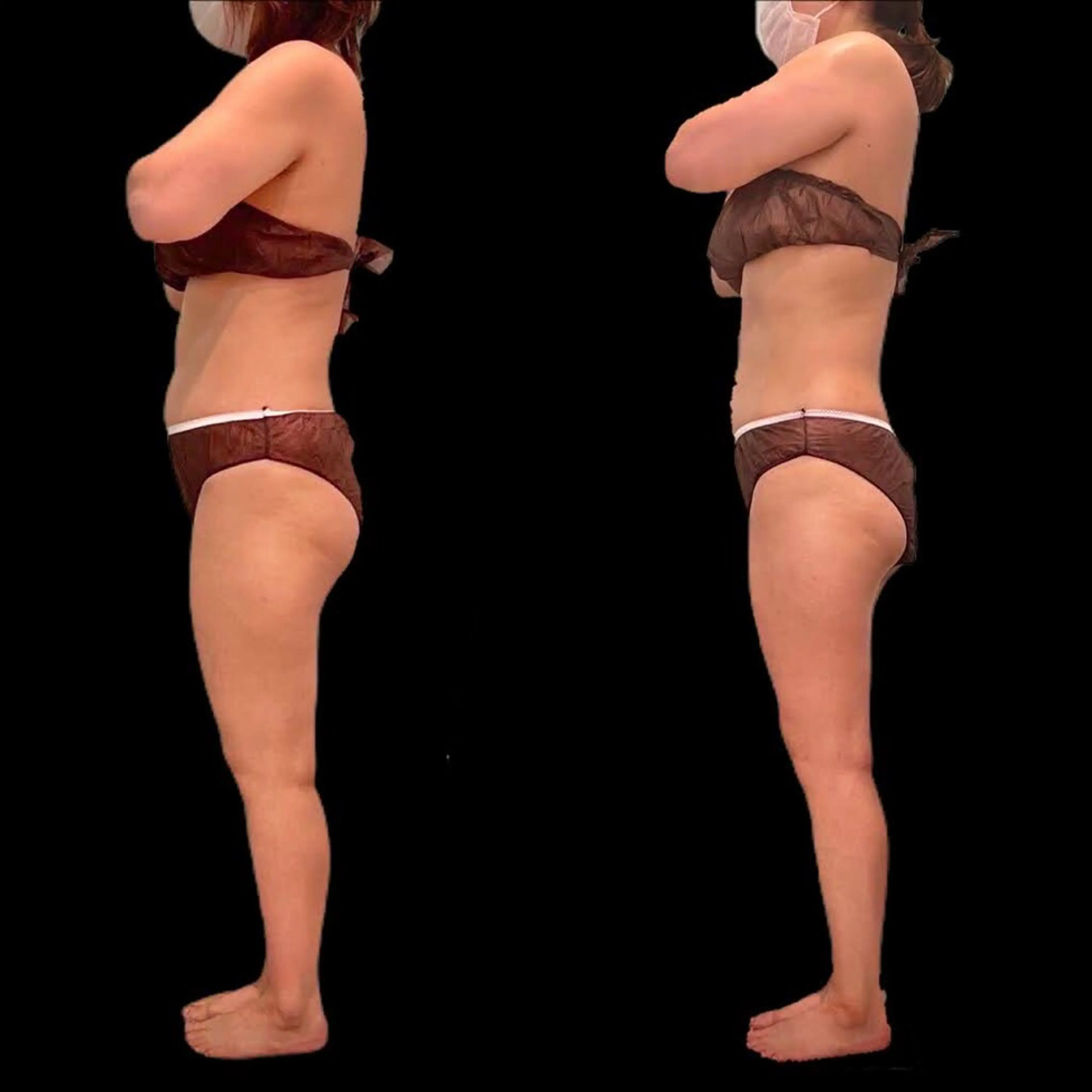 Nature（ナチュレ）所属・【脳洗浄/痩身】 nature東金のエステ・リラクイメージ