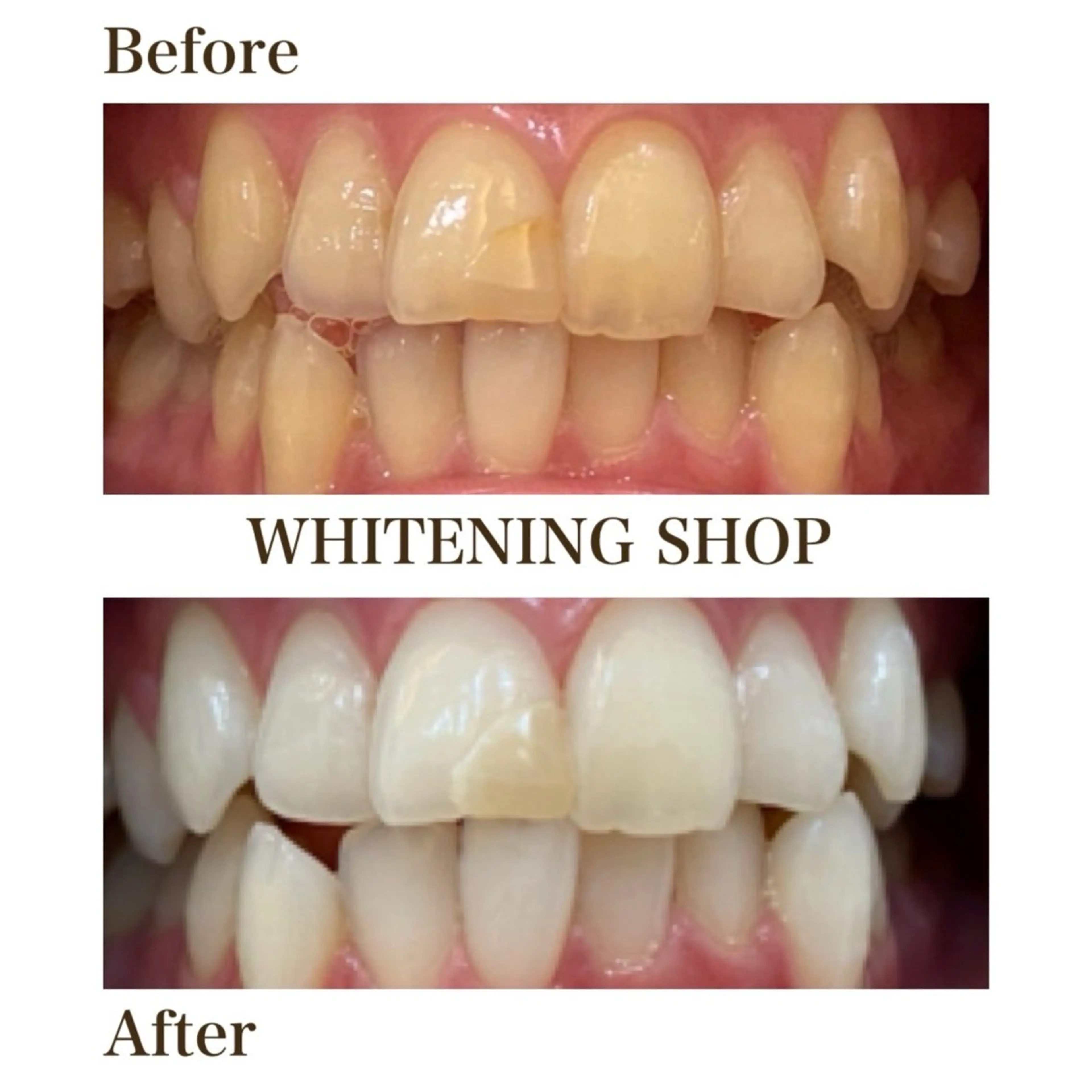 ホワイトニング ショップ銀座7丁目店のその他イメージ