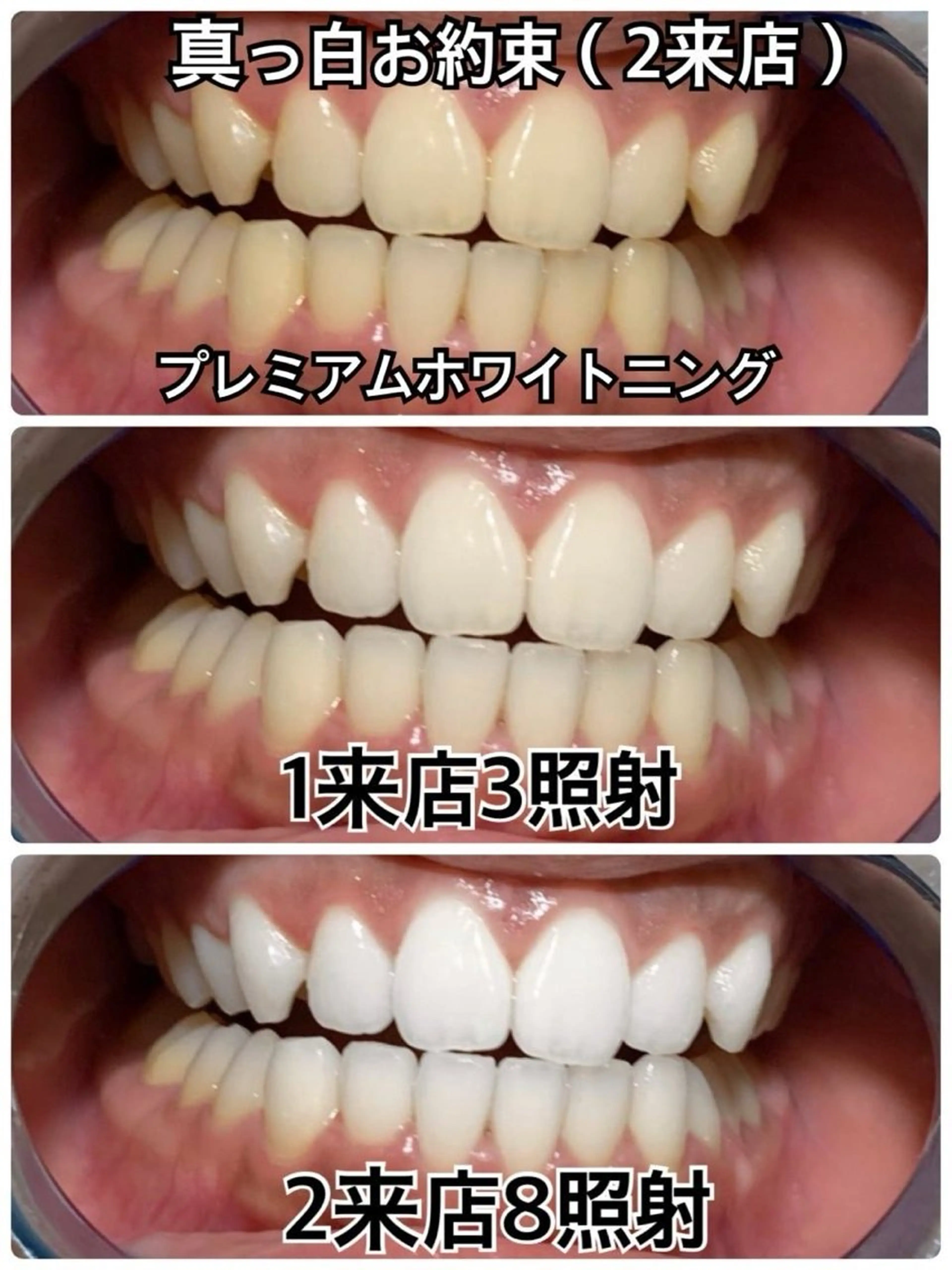 その他 WhiteningBeauty吉祥寺店所属・店舗代表 タクミのその他イメージ