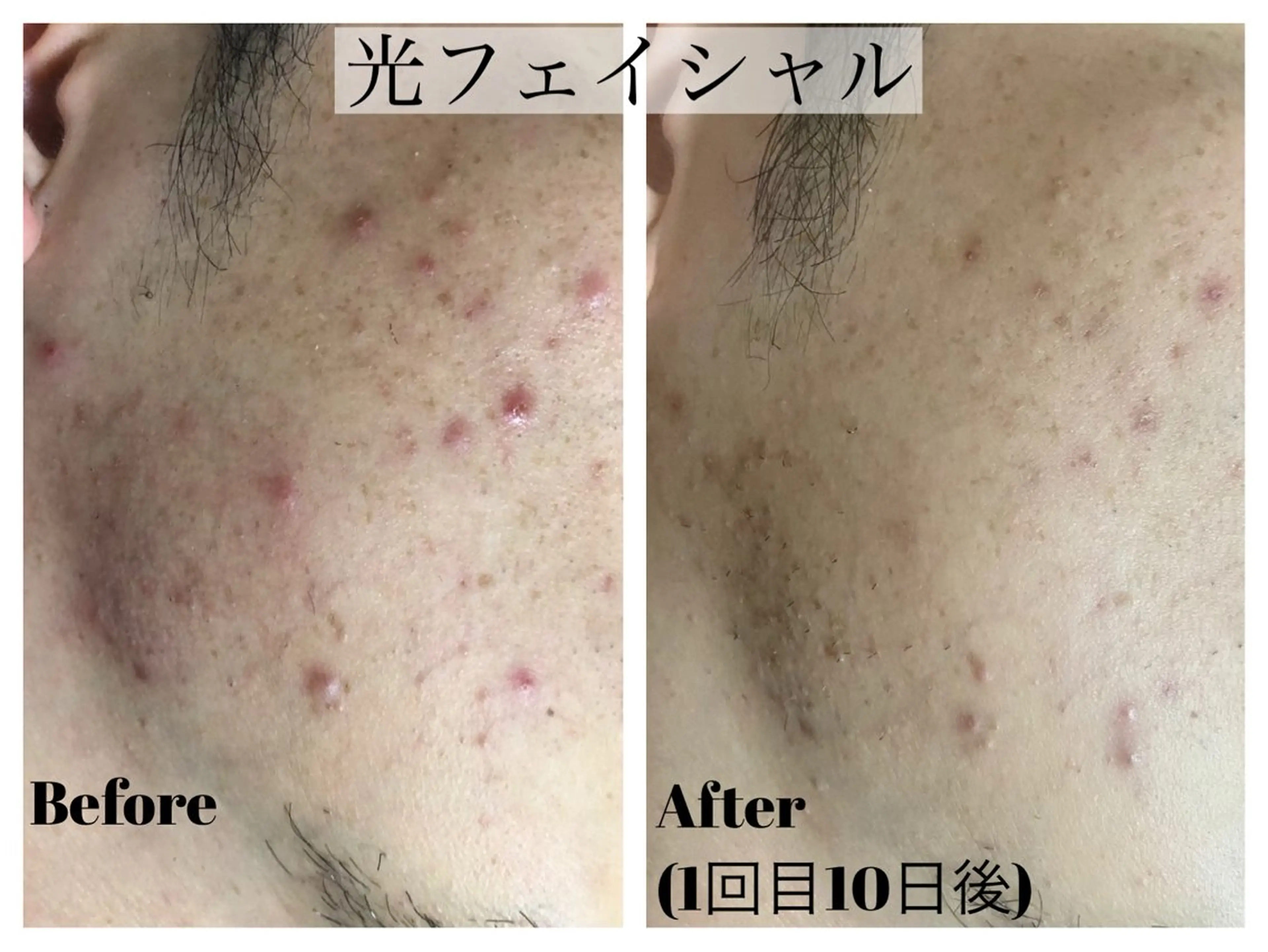 エステ LiZA エステティックサロンのその他イメージ