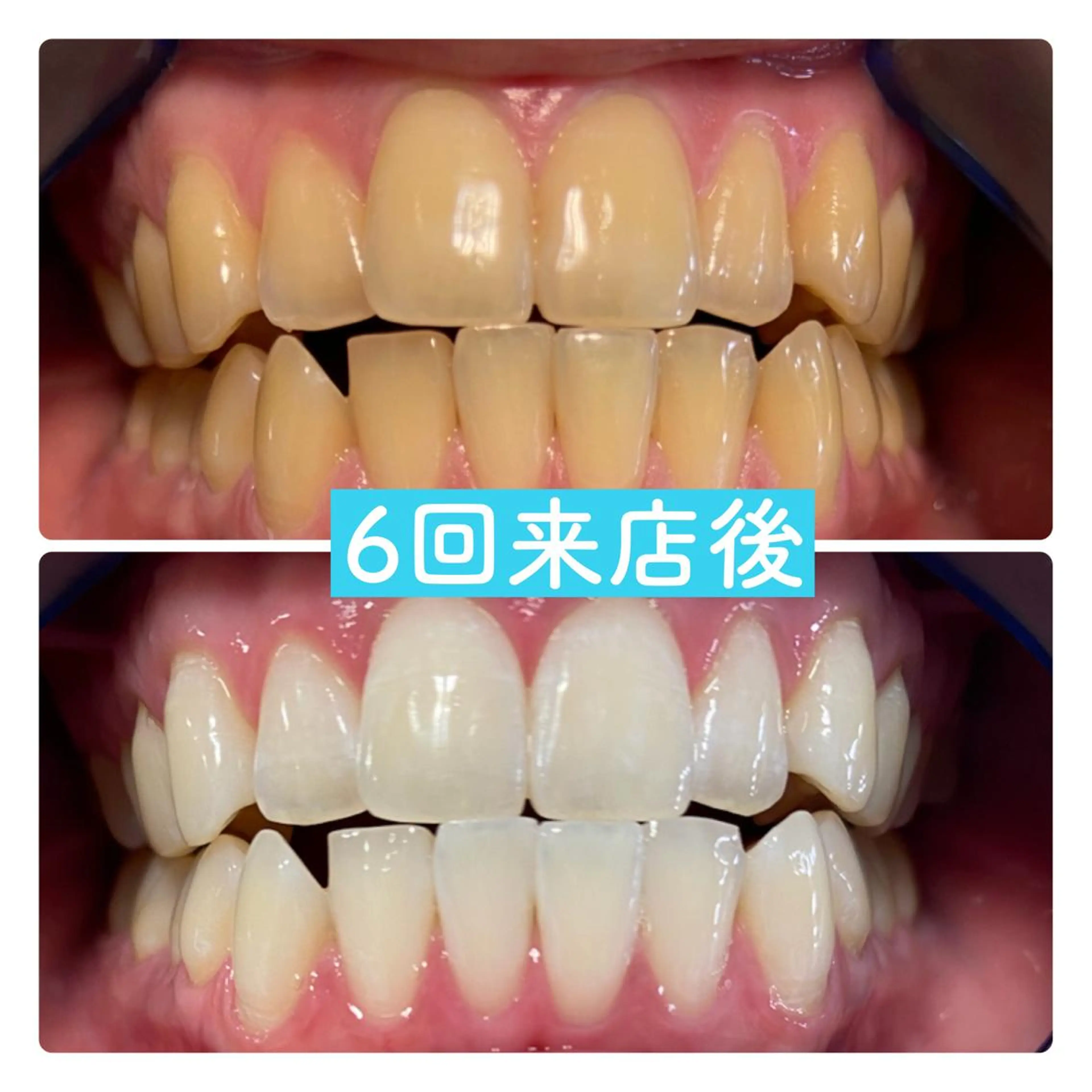 その他 PLATINUM Beauty 横浜店所属・ホワイトニングルーム 横浜店のその他イメージ