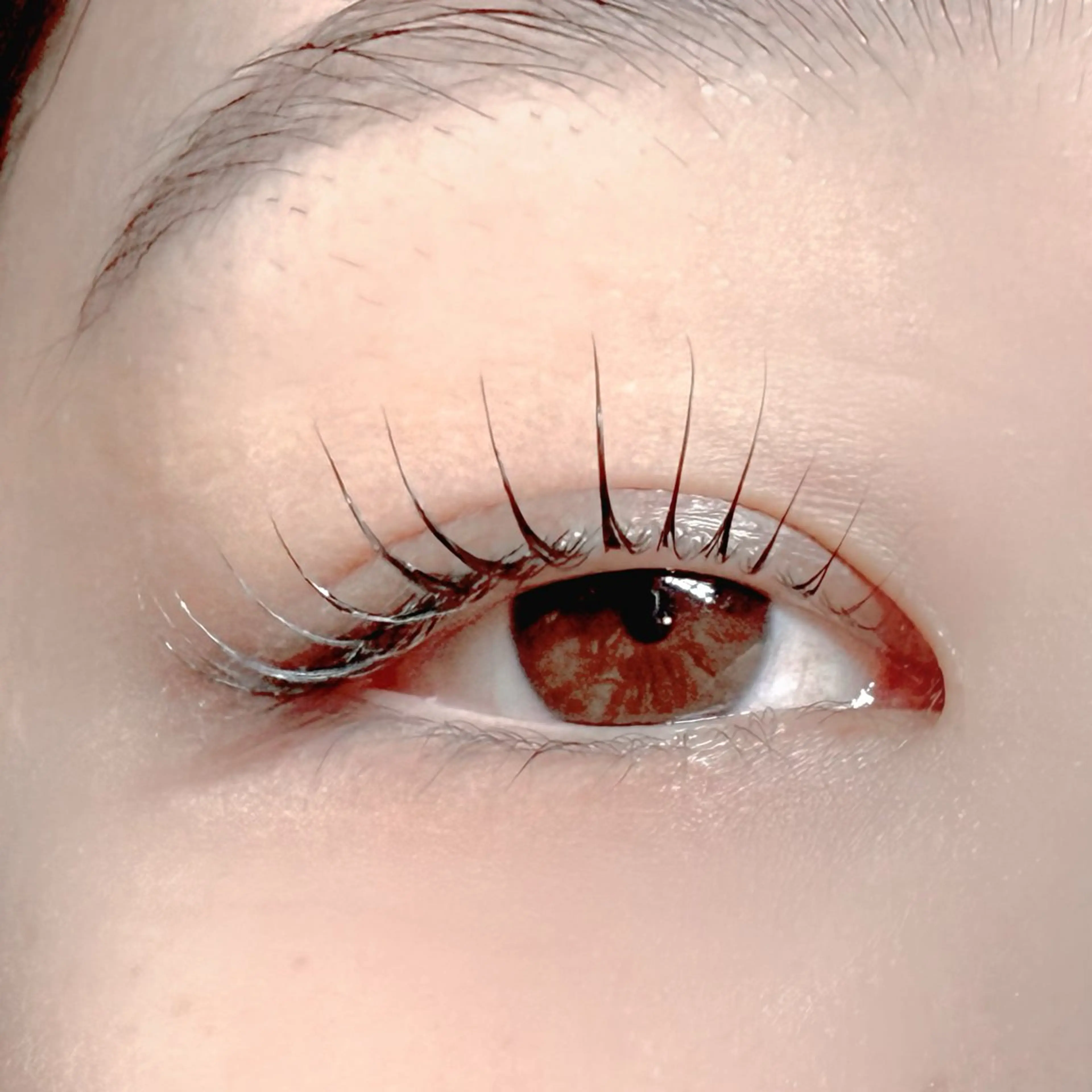 メーテルラッシュの写真