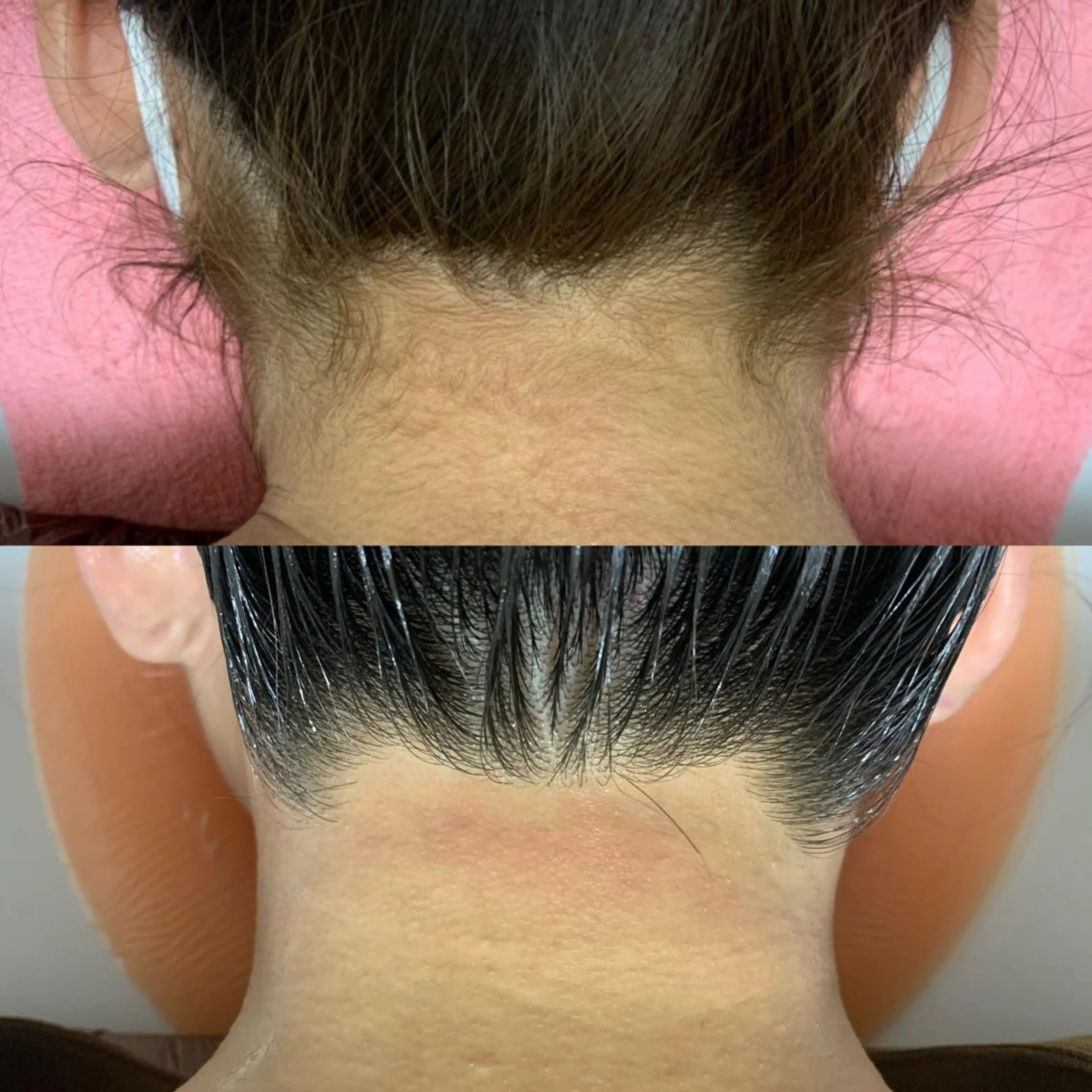 脱毛 透明感の肌Lino malieのエステ・リラクイメージ