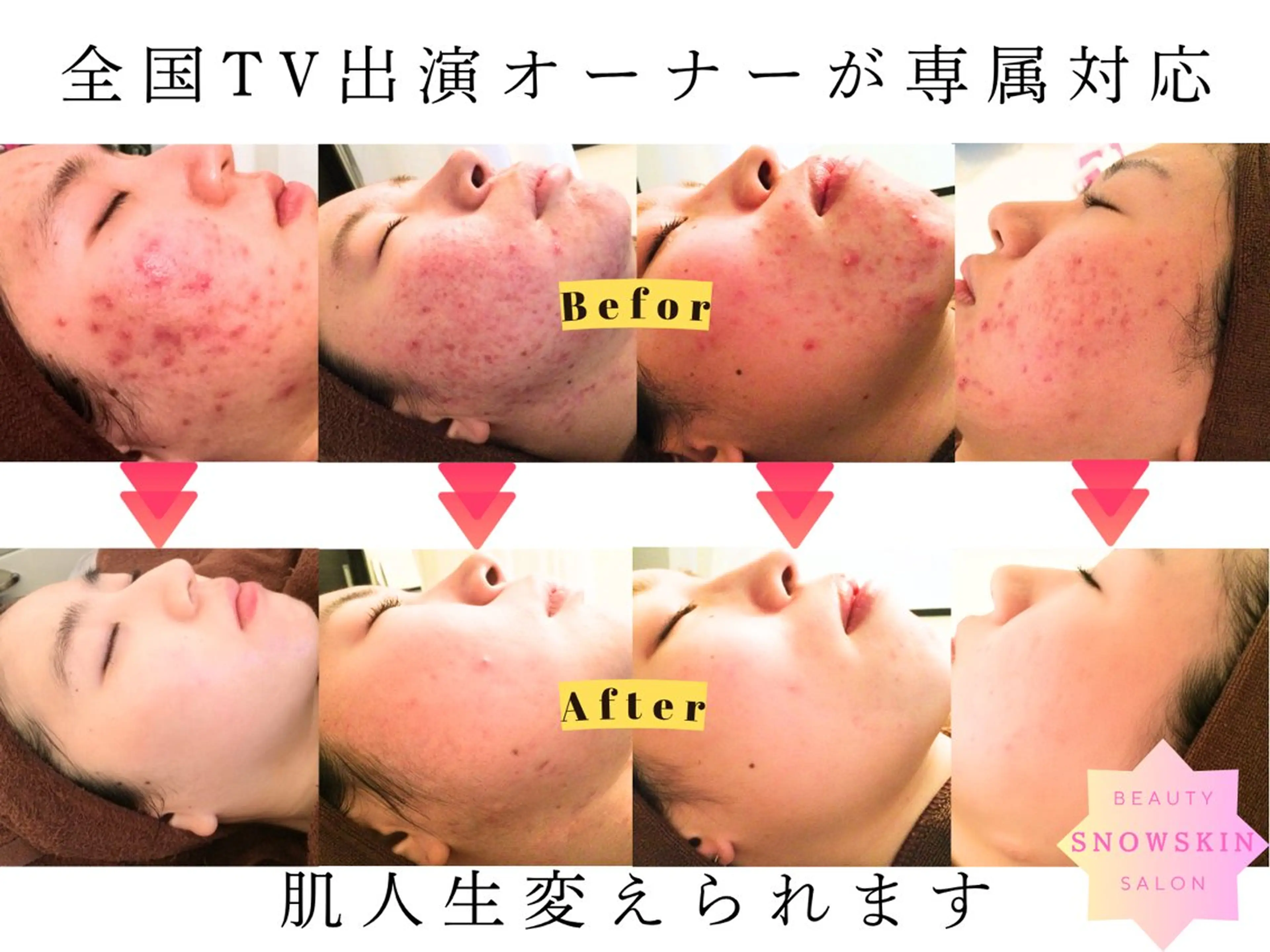 ニキビ/肌質改善専門 Snow skinのエステ・リラクイメージ