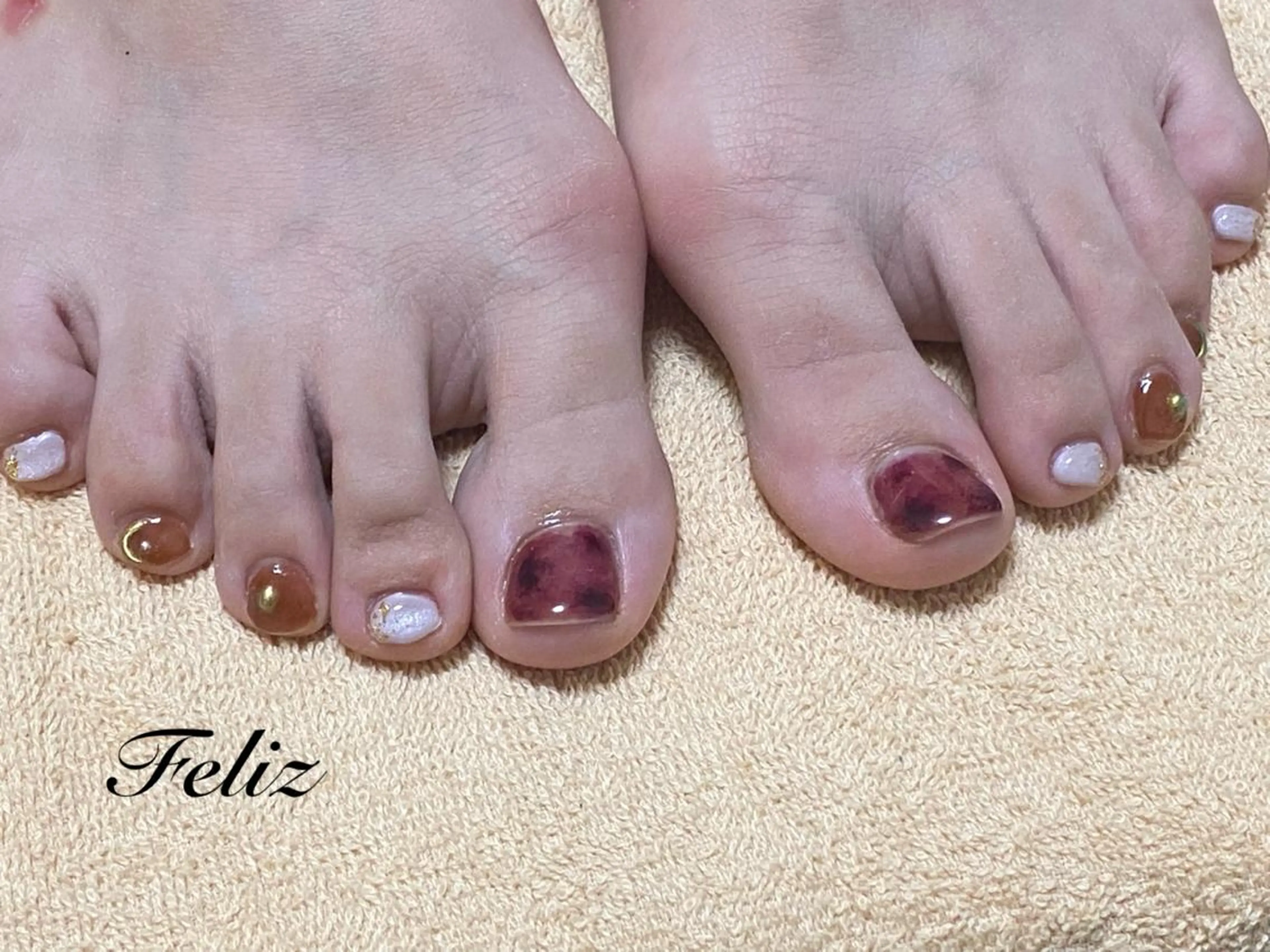 ネイル フットネイル 痛ネイル/ワンホン/ フィルイン/長さだしのネイルデザイン