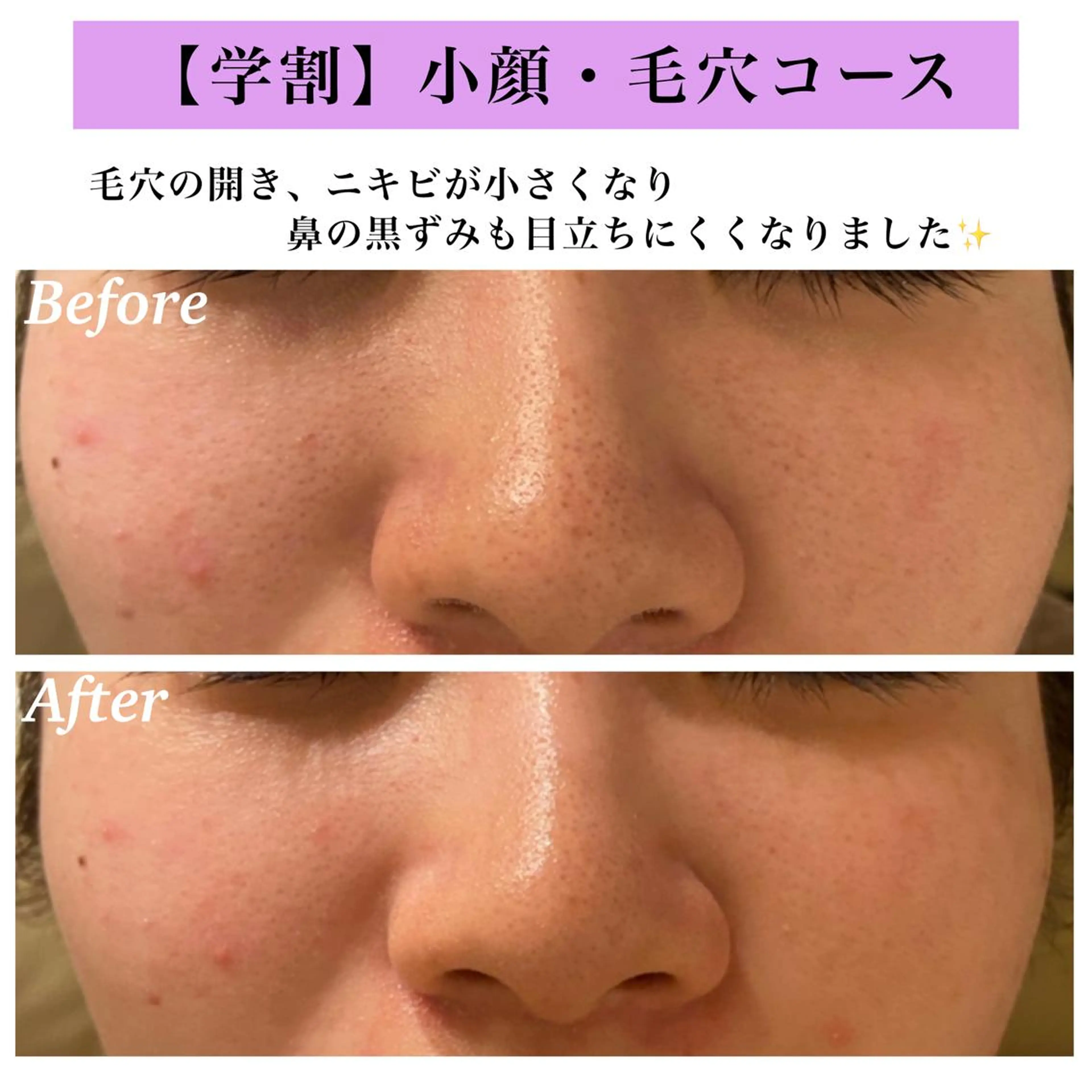 Bellesthe (ベルエステ)のエステ・リラクイメージ