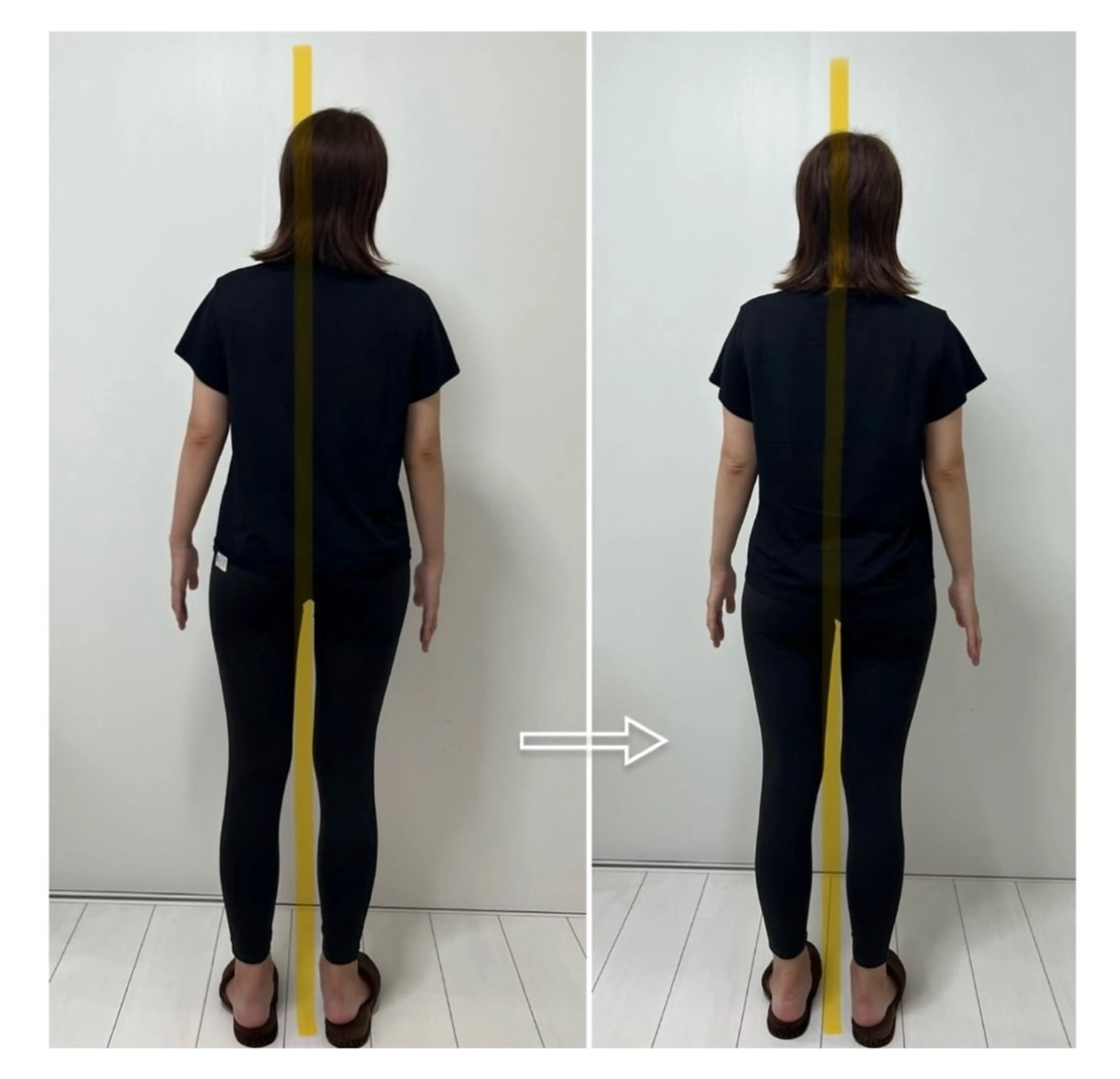 プレミアム💍ドレス映え美ライン集中ケアの写真