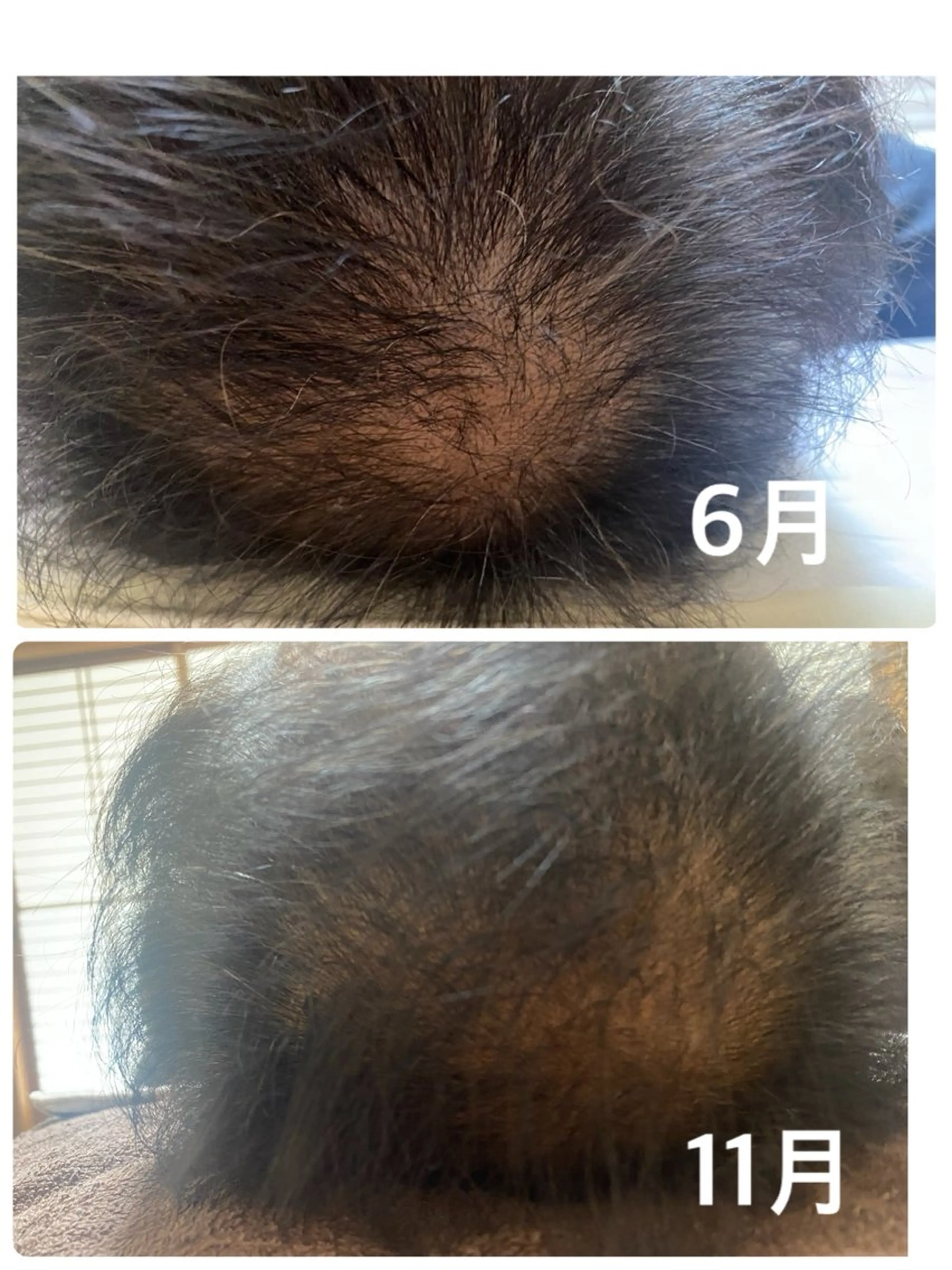 グリーンピールヘアブーストの写真