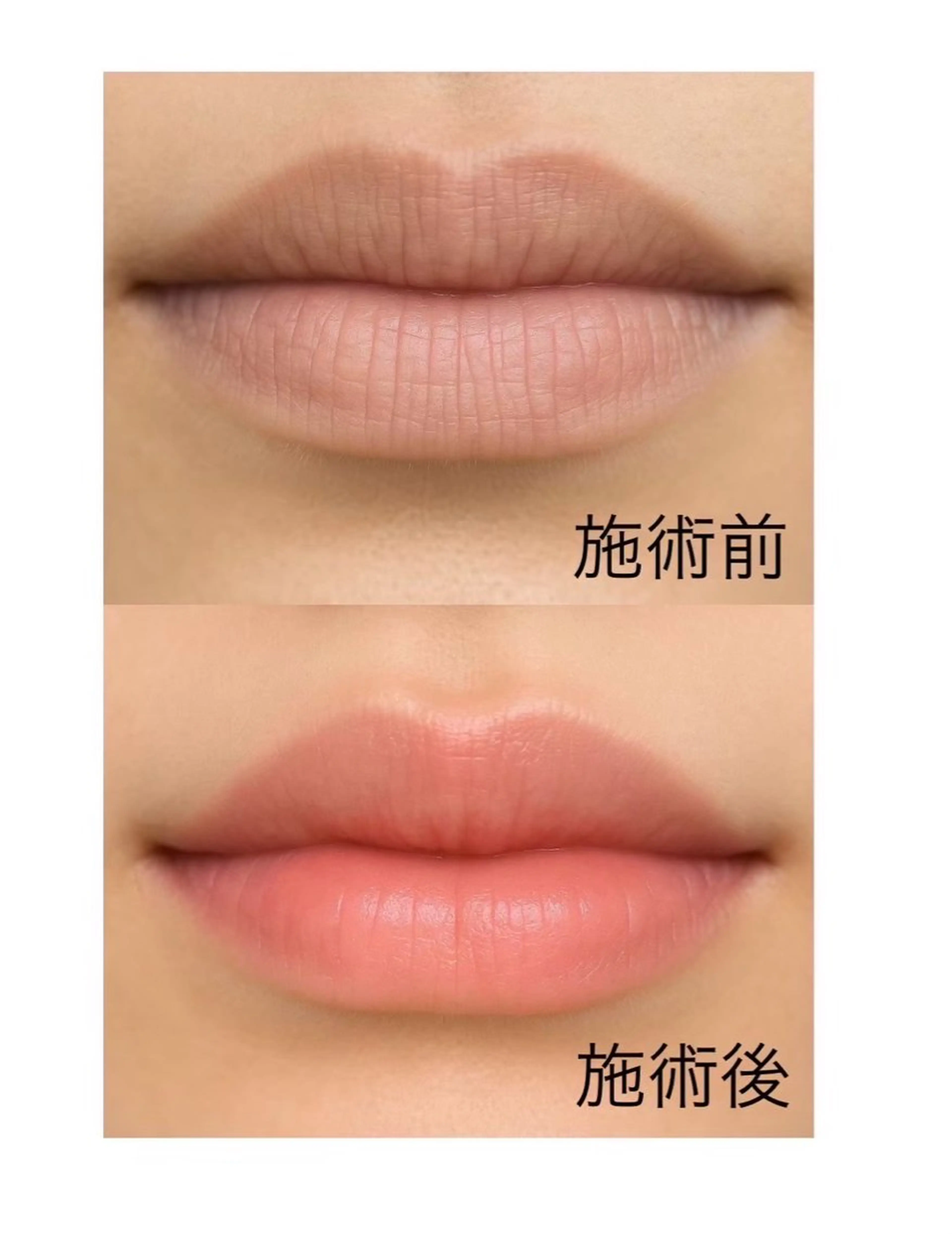 esperanza エスペランサのエステ・リラクイメージ