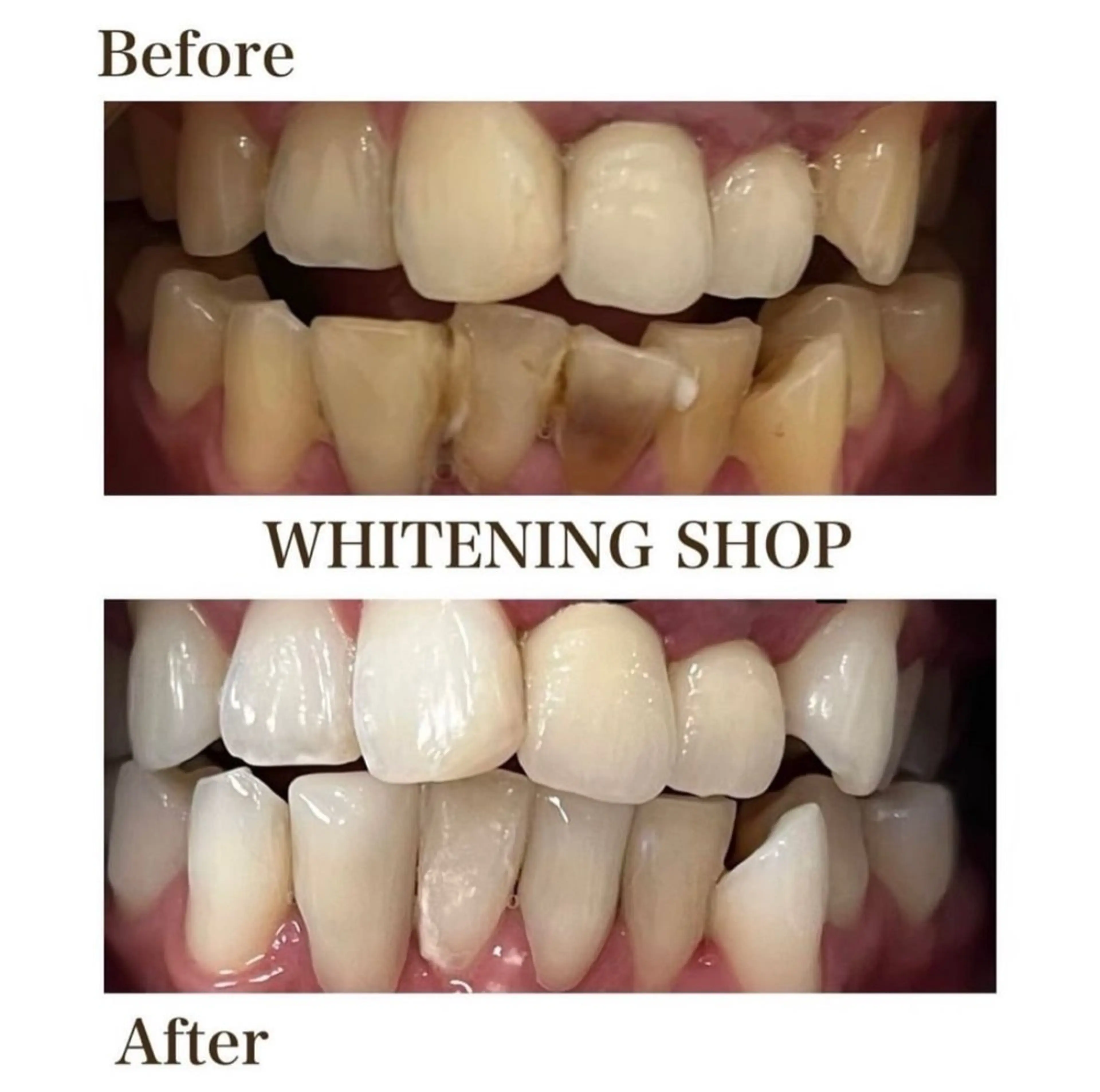 ホワイトニングショップ伊丹店所属・ホワイトニング ショップ伊丹店のその他イメージ