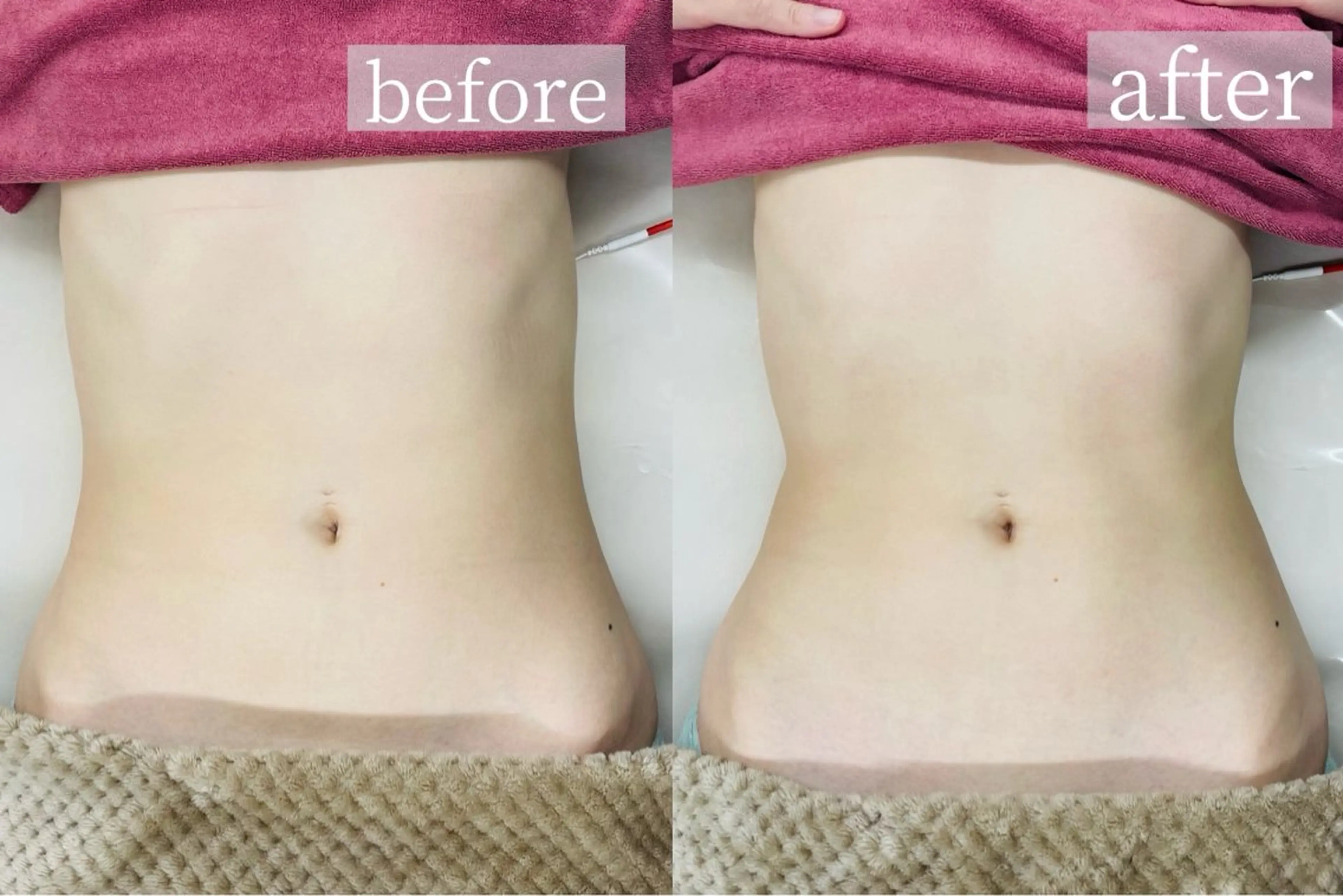 筋膜リンパ60分｜筋膜ほぐし＋深層筋＋リンパ✿厚み・たるみ解消 リメイクリンパ✿の写真