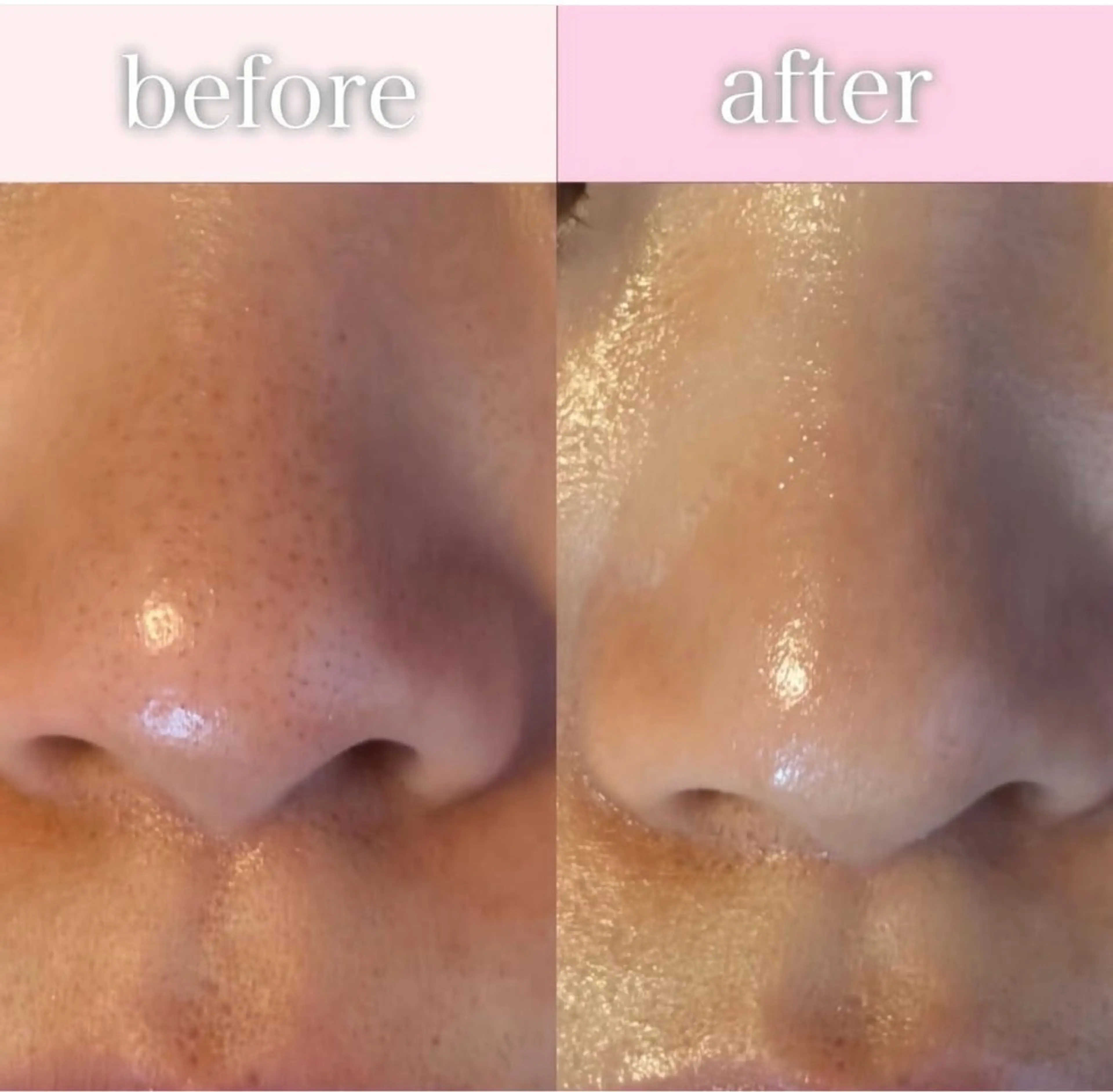 ソワン所属・脱毛 フェイシャル soin～ソワン～のエステ・リラクイメージ