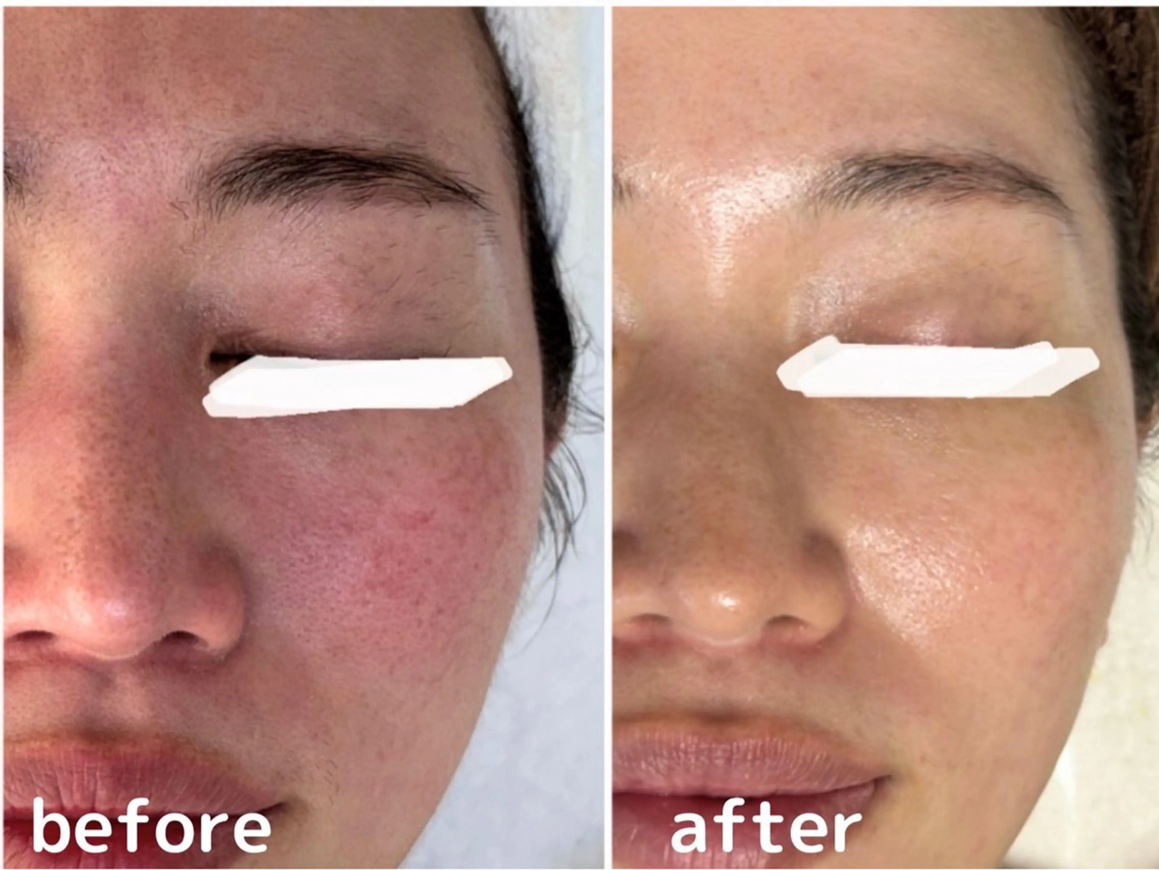 エステ リラク 田中For..天王寺 肌質改善/よもぎ蒸しのエステ・リラクイメージ