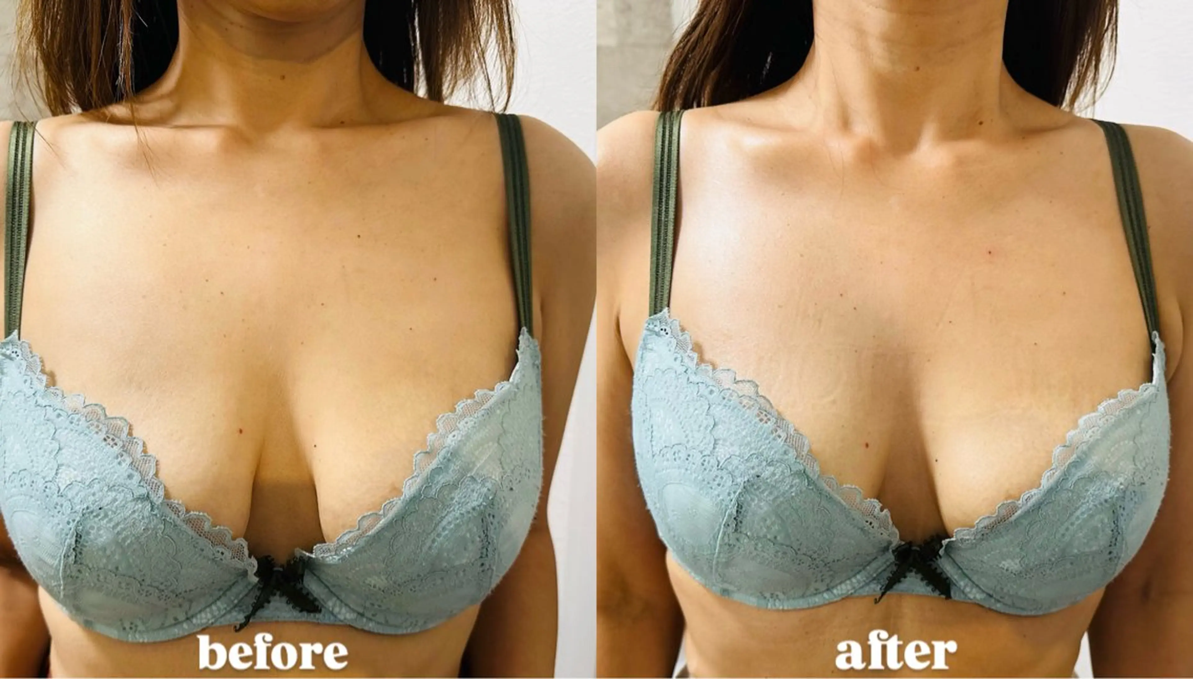 まるで豊胸⁉️卒乳後ママに大人気🌟光バストケアコース🌟通常13,000円→初回6,980円の写真