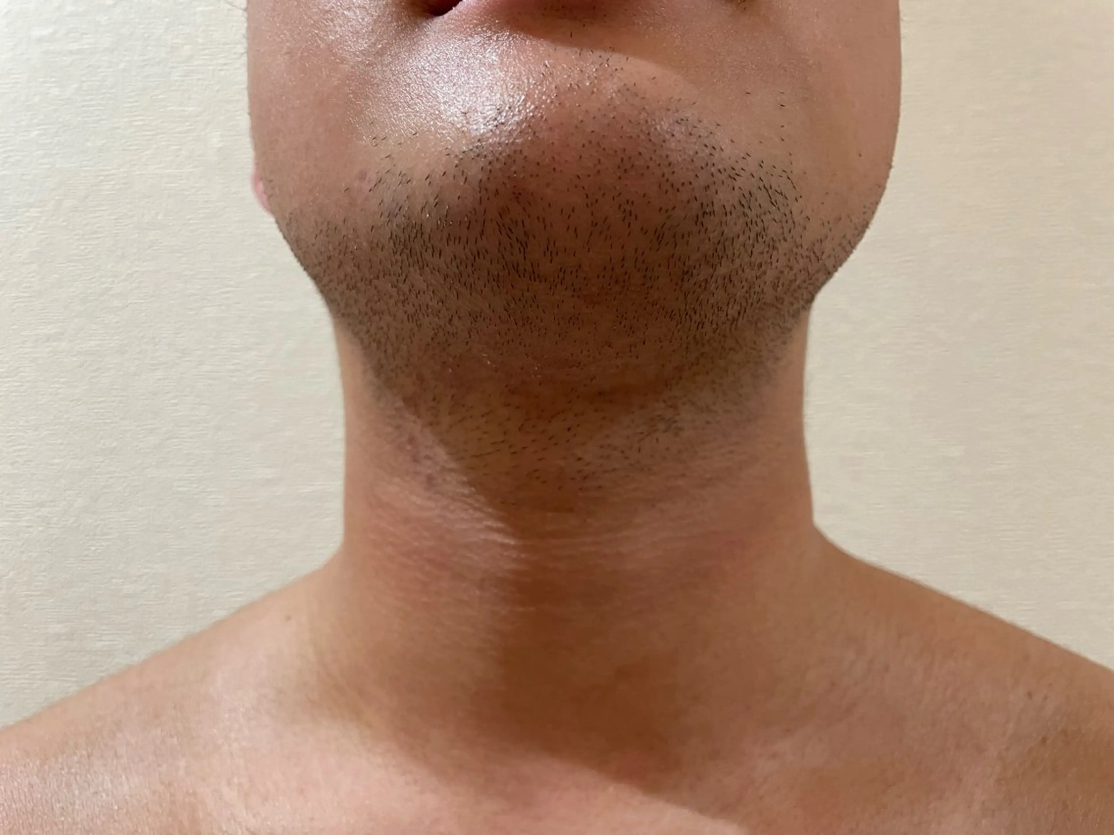 メンズ dion.kobe所属・脱毛リラグゼーション dion.kobeのエステ・リラクイメージ