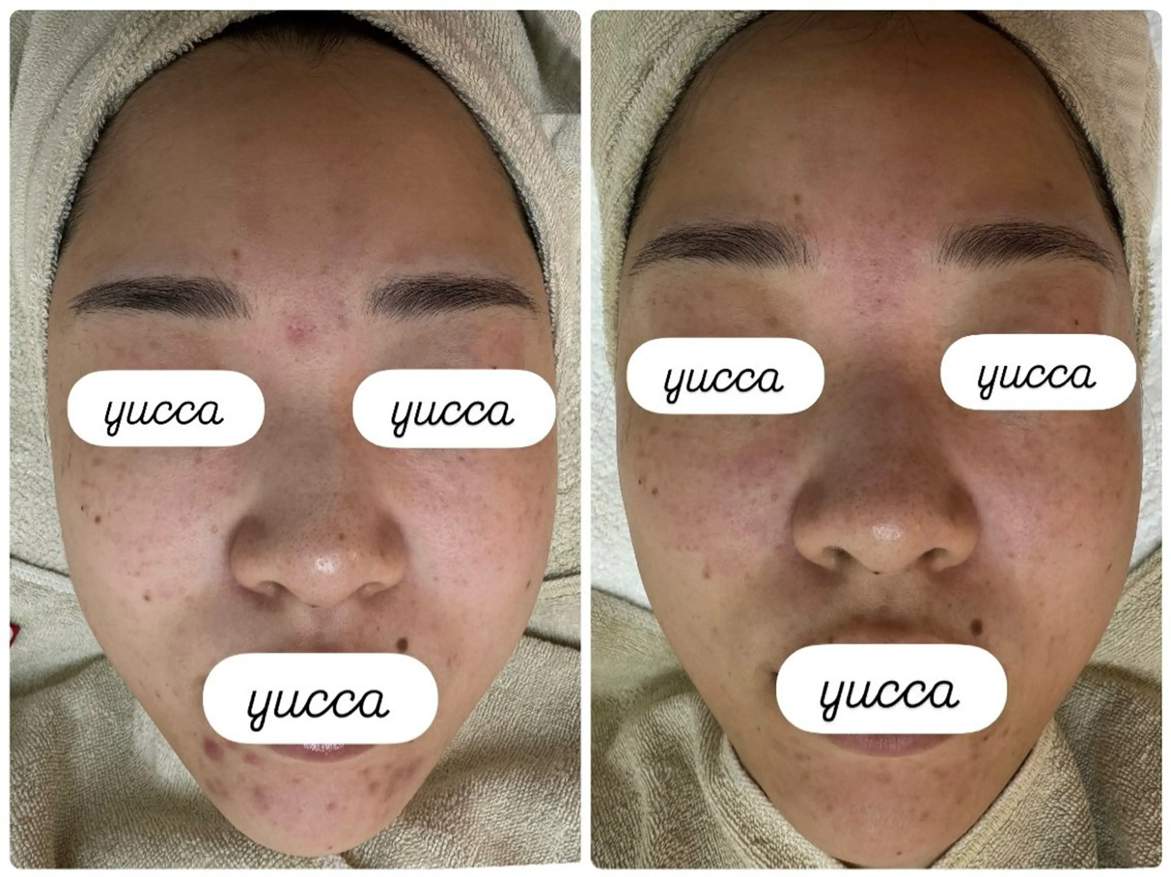 エステ リラク シミ毛穴専門店 yucca(ユッカ)のエステ・リラクイメージ