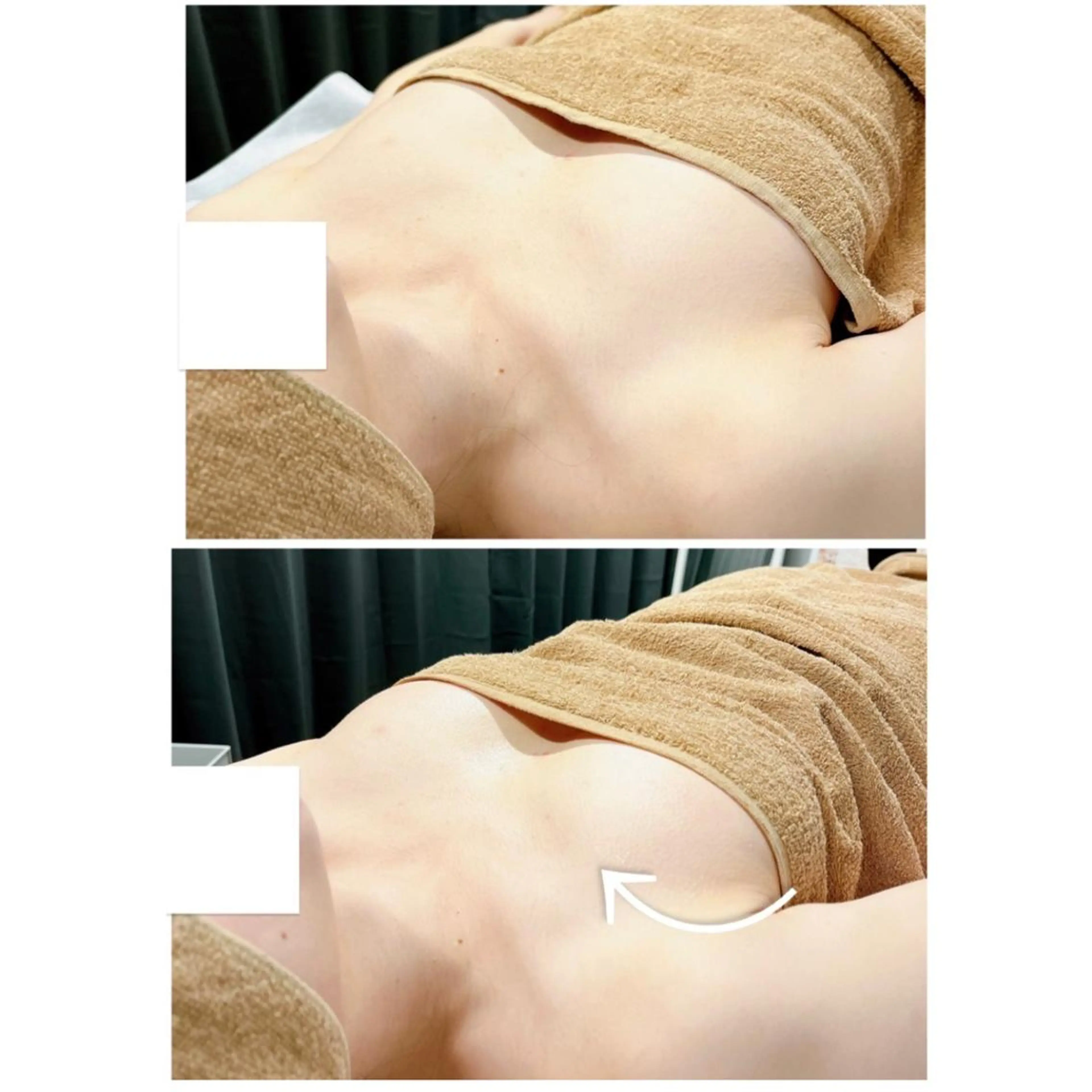 思わず触りたくなるふわふわ美乳☁️🌈👙BBL光バストアップ👙1日2名限定メニュー🍧💫の写真