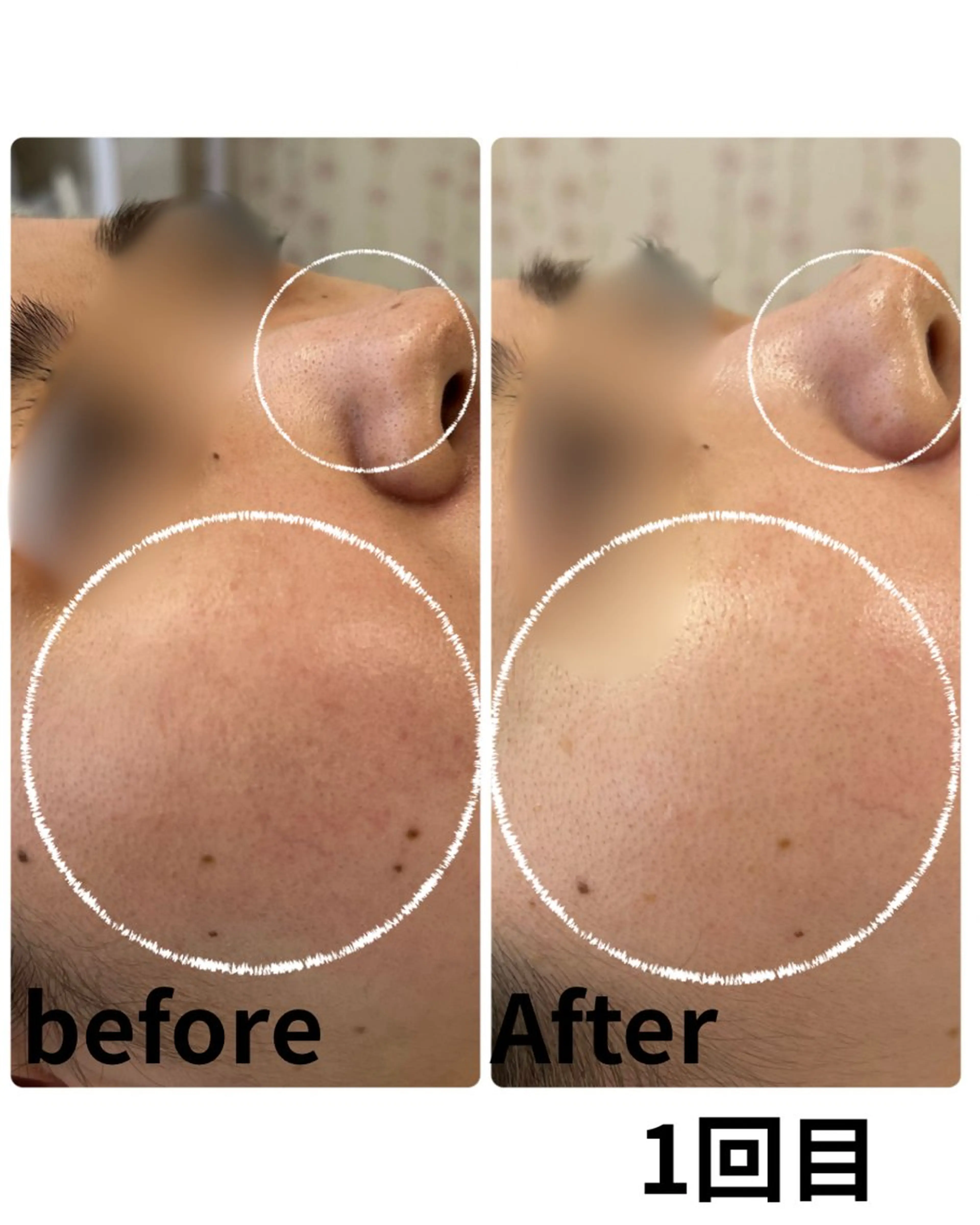 エステ Astorie 相模大野エステのその他イメージ