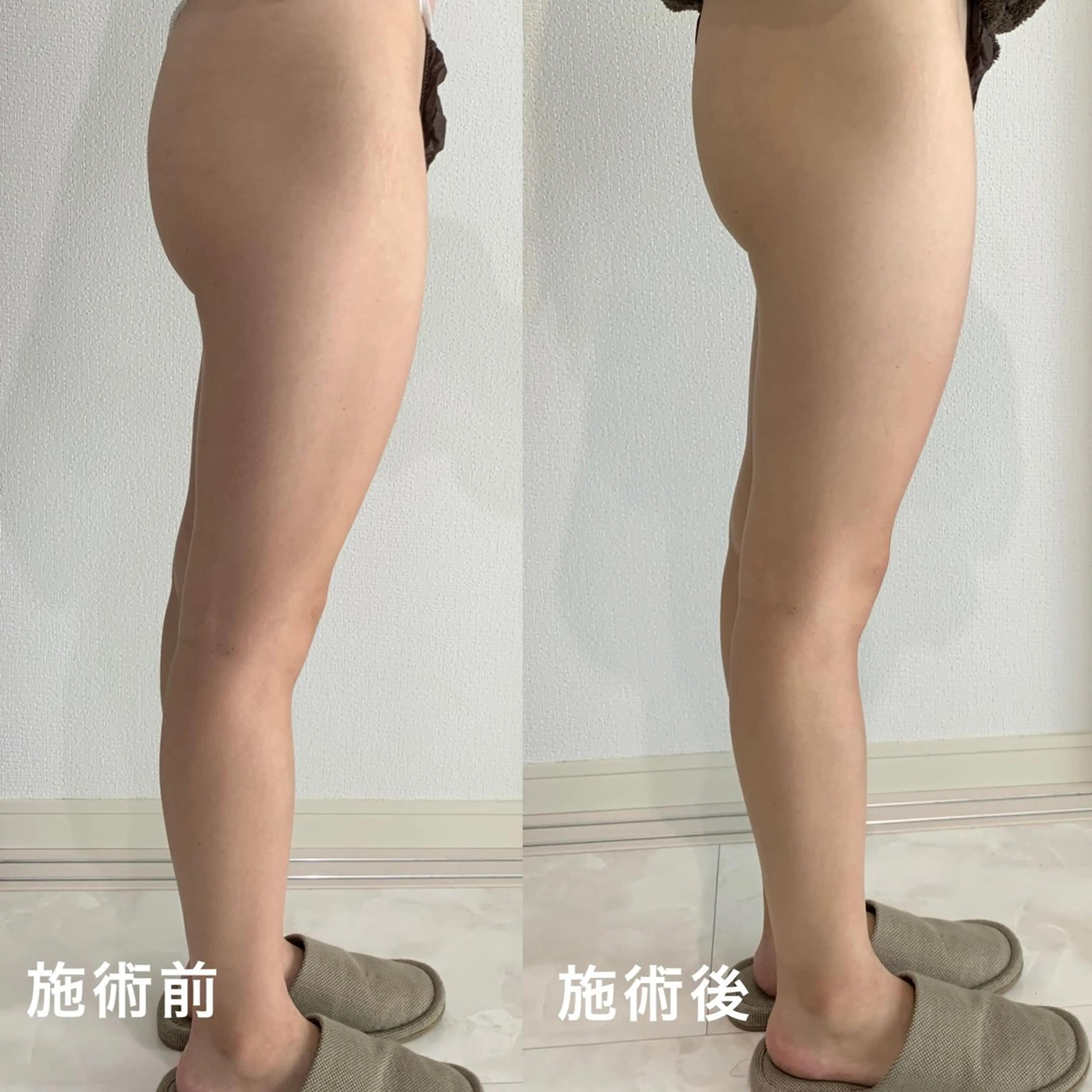 堀之内宏次 ［美容鍼灸師］のエステ・リラクイメージ