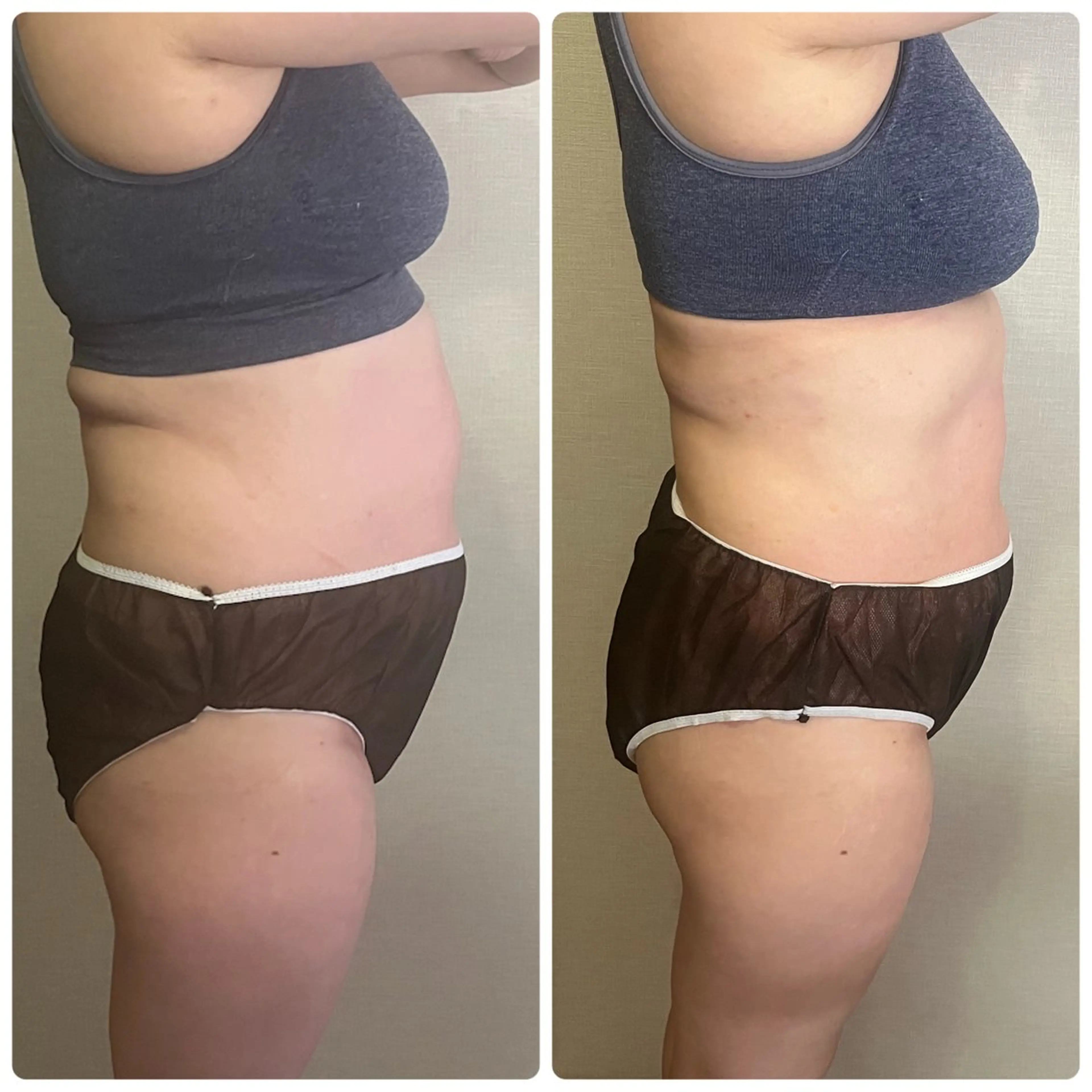 アロマ･美容鍼･カッ ピング「麗」鍼灸院のエステ・リラクイメージ