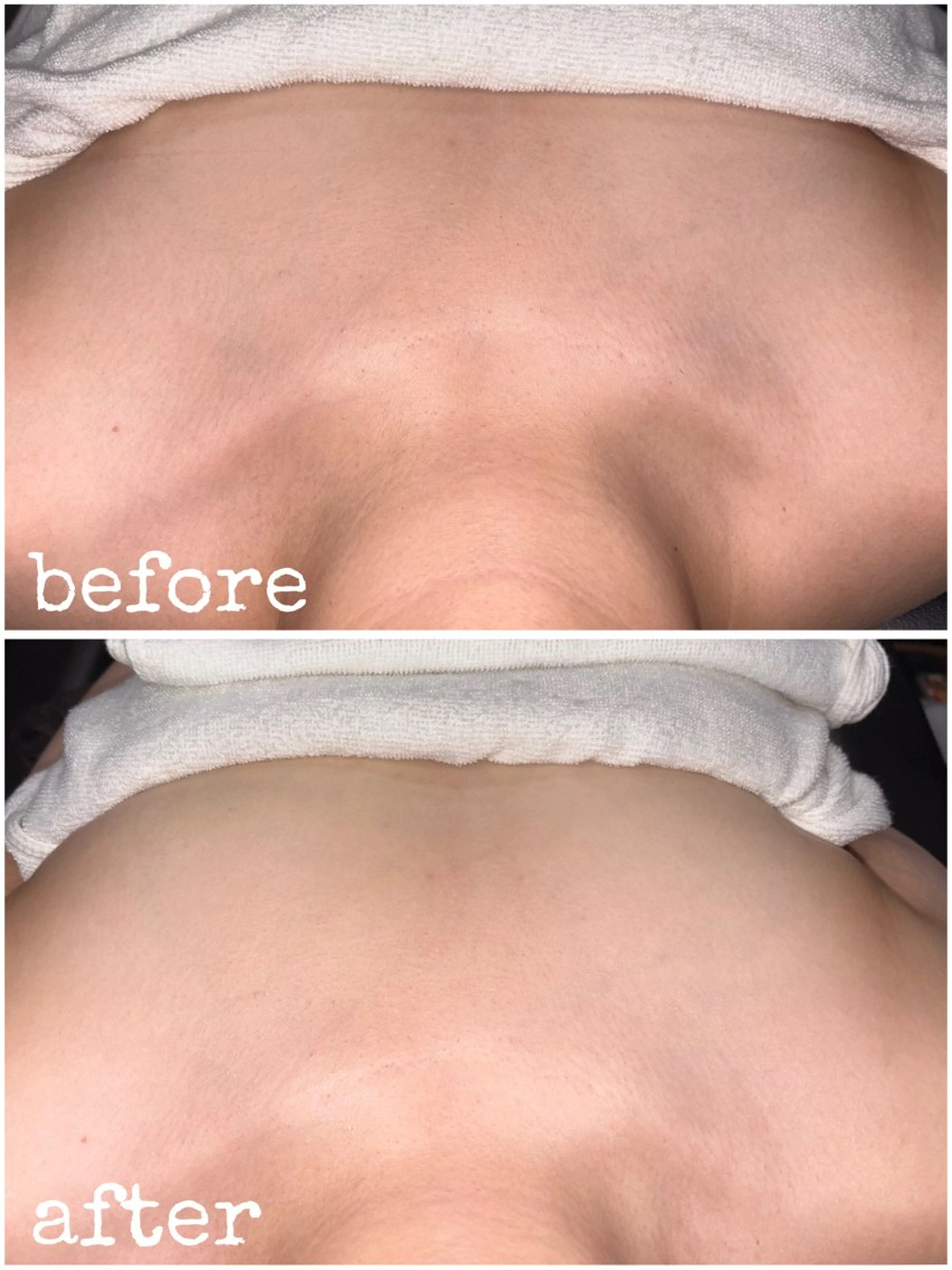 練習モデル 平日21時〜、土日祝20時〜 ブライダルシェービングコース(顔剃り×)施術内容確認してくださいの写真