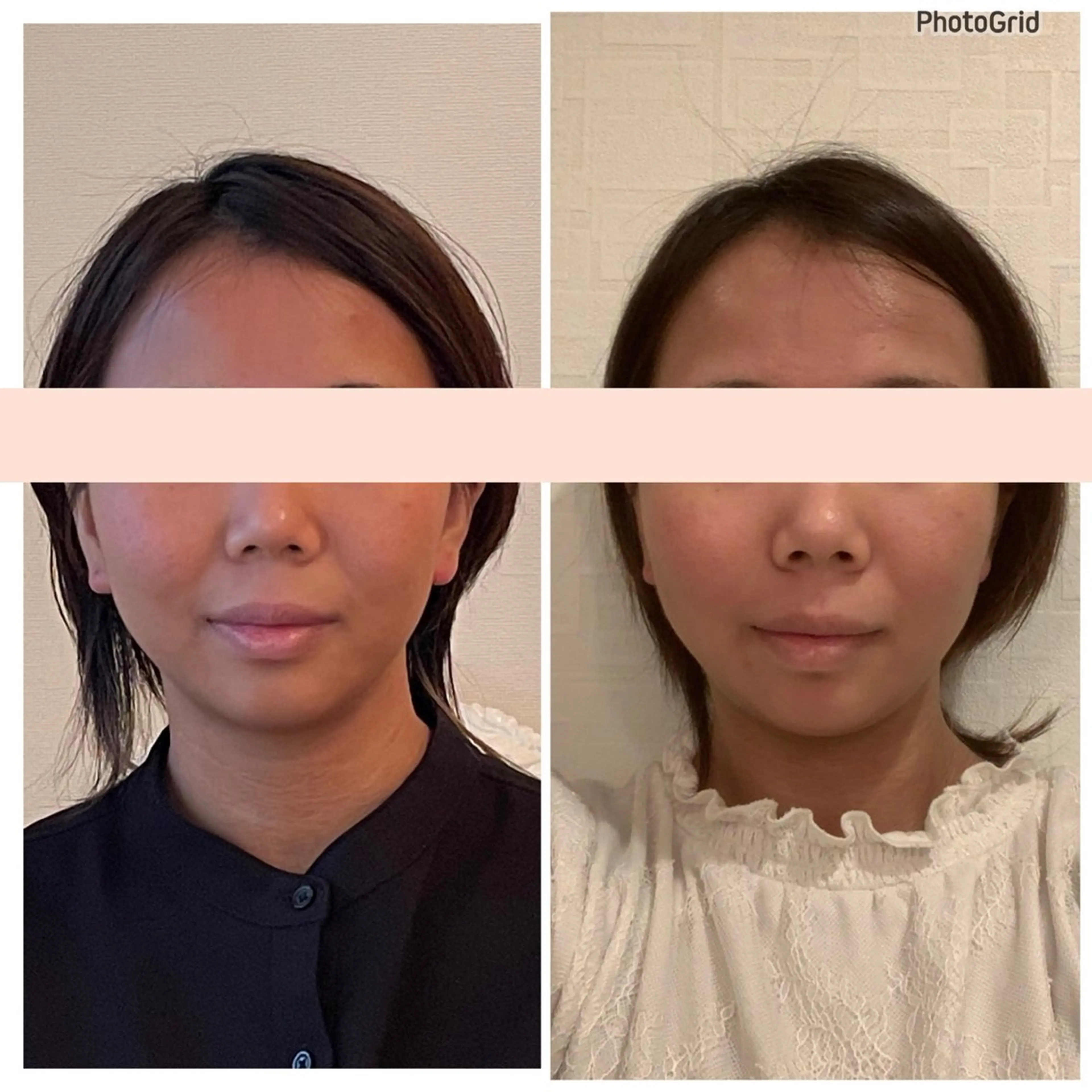 小顔矯正サロン　ReFace Fusae（リフェイスフサエ）所属・小顔矯正サロン リフェイスフサエのエステ・リラクイメージ