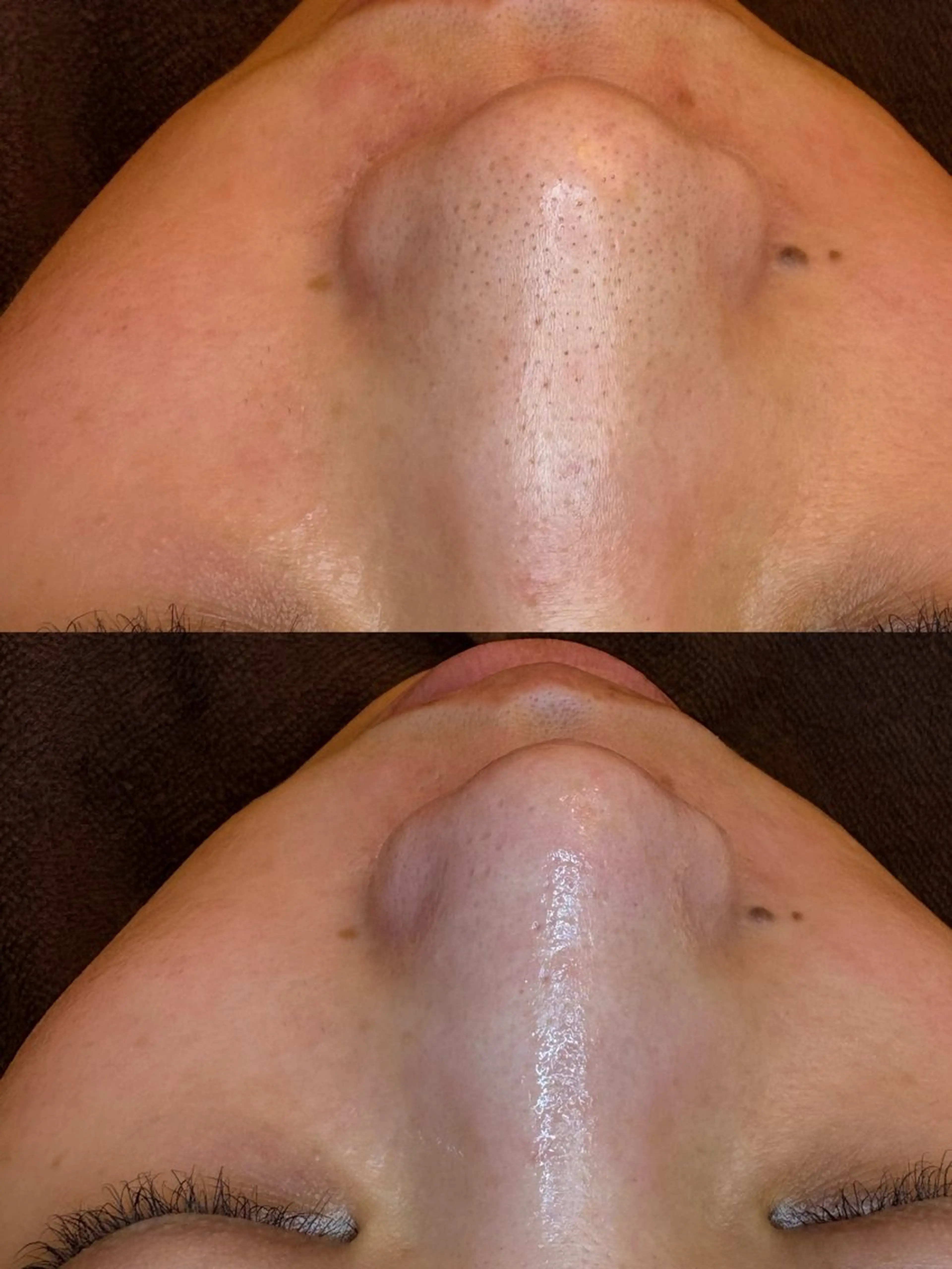 エステ EARTH coiffure beaute 新潟紫竹山店所属・🤍アベシュリ /フェイシャル🤍のエステ・リラクイメージ