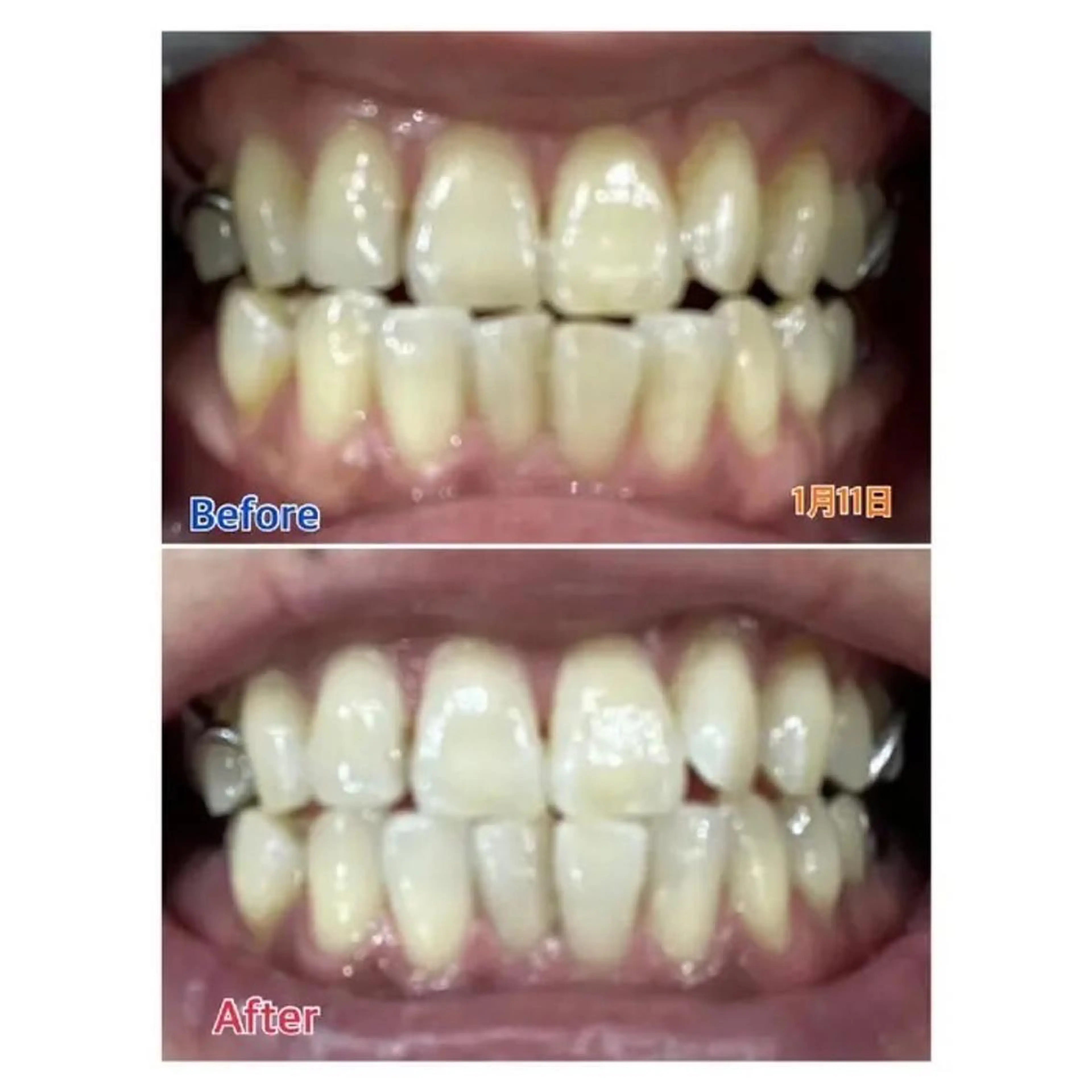 M渋谷店所属・Ｍ渋谷 ホワイトニングのエステ・リラクイメージ