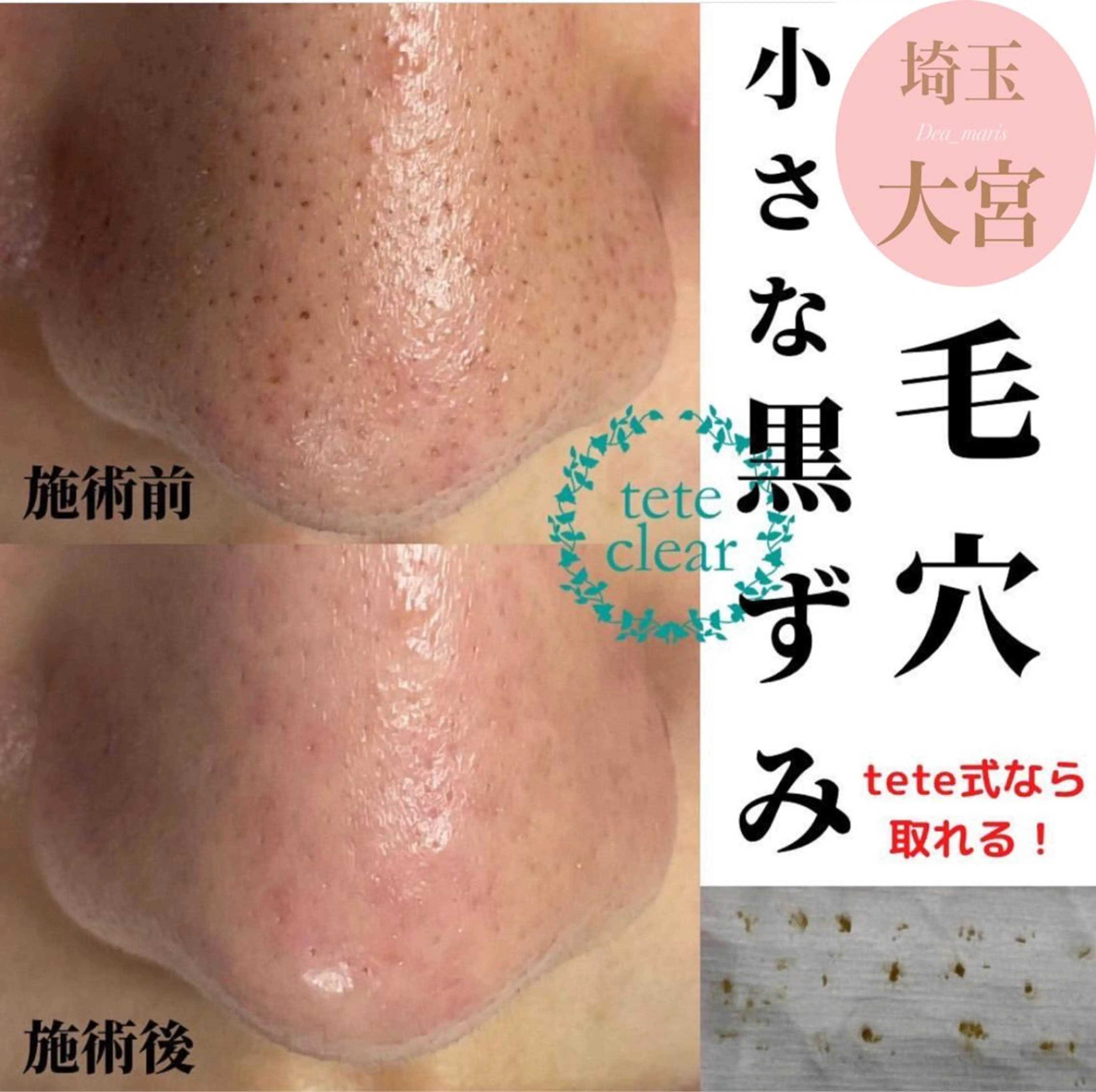 private salon  Dea_maris シュガーリング＆パーソナルボディケア所属・シミ改善・韓国肌管理 ボディメイク痩身のその他イメージ