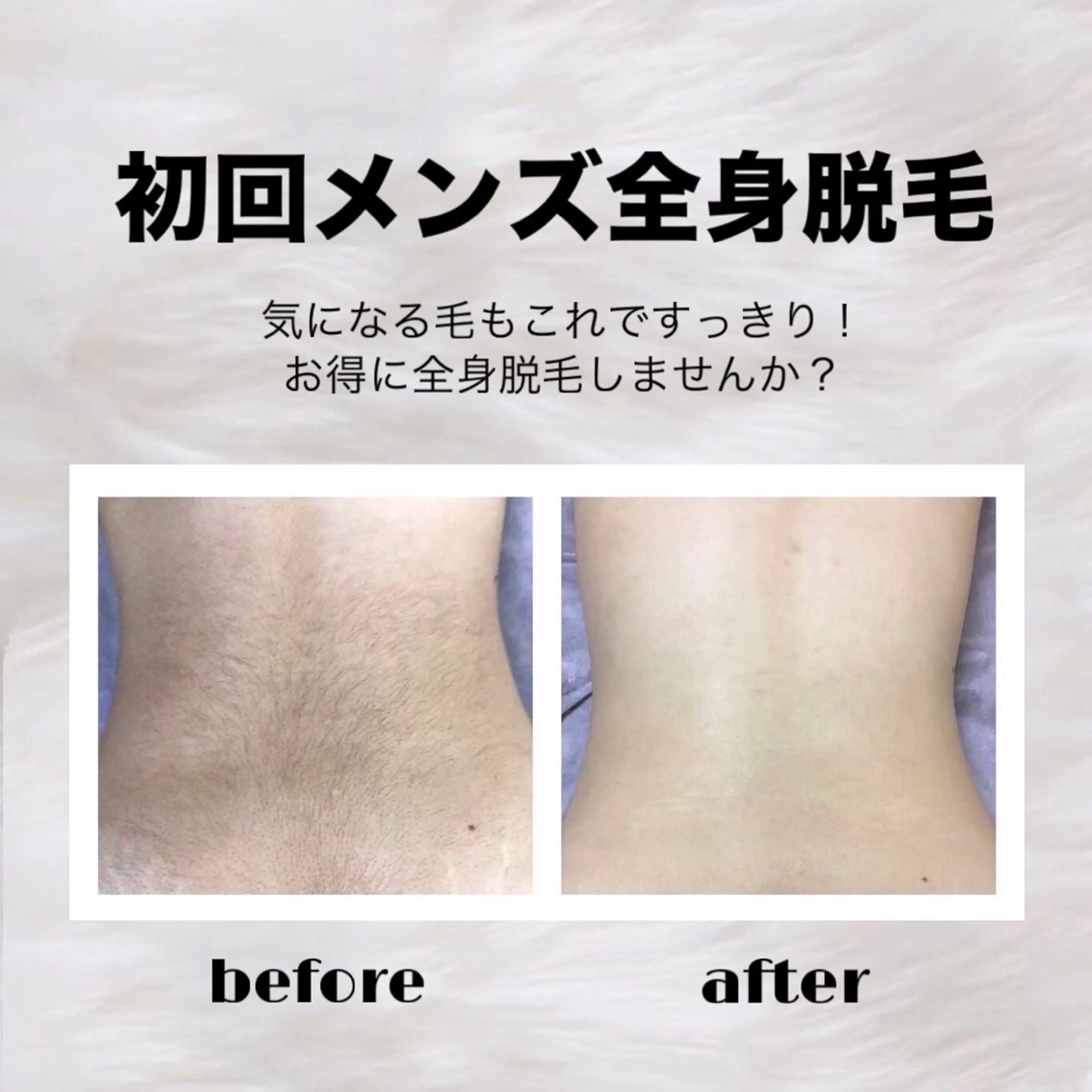 👨🏻初回メンズ脱毛👨🏻全身脱毛(顔、VIO含まない)🍀特別価格🍀の写真