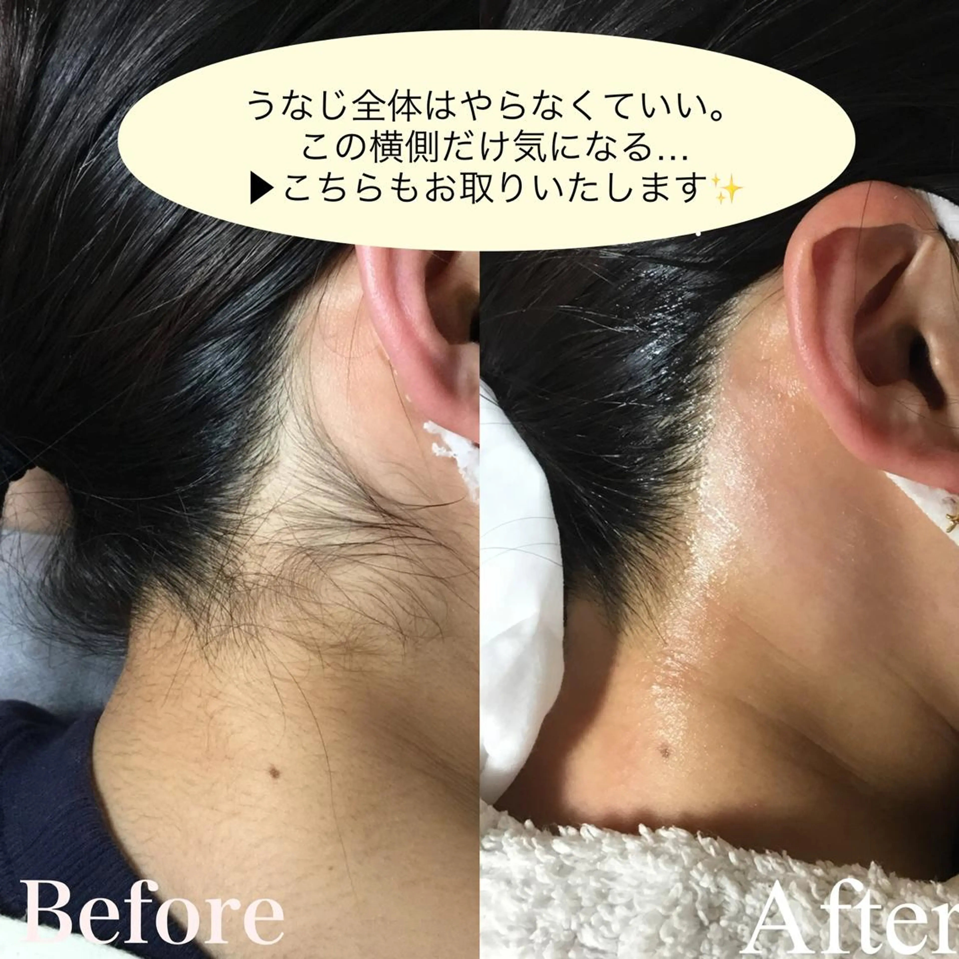 HOTEL&PARK . ワックス脱毛のエステ・リラクイメージ