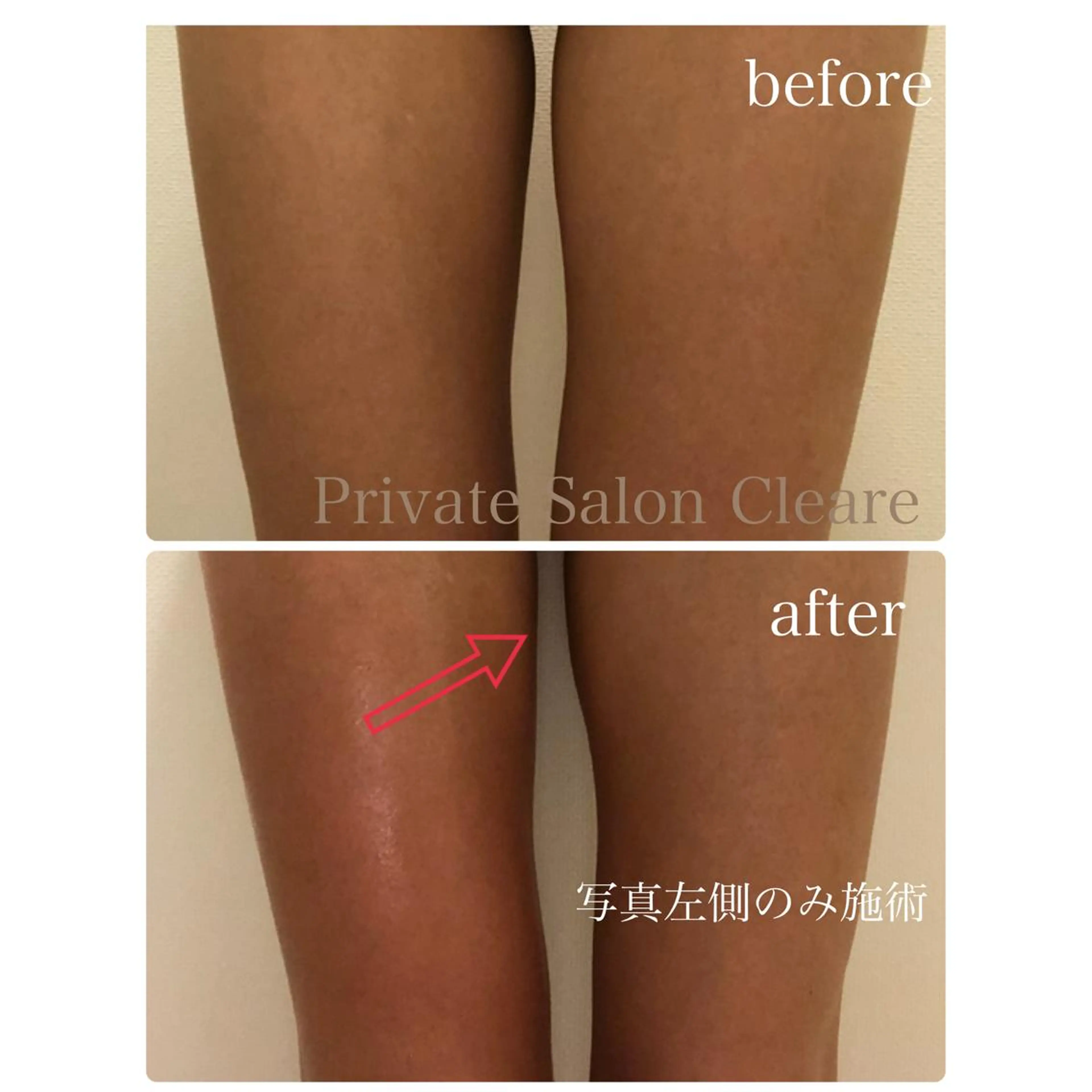 体の中から肌質改善 クレール　奈良のエステ・リラクイメージ