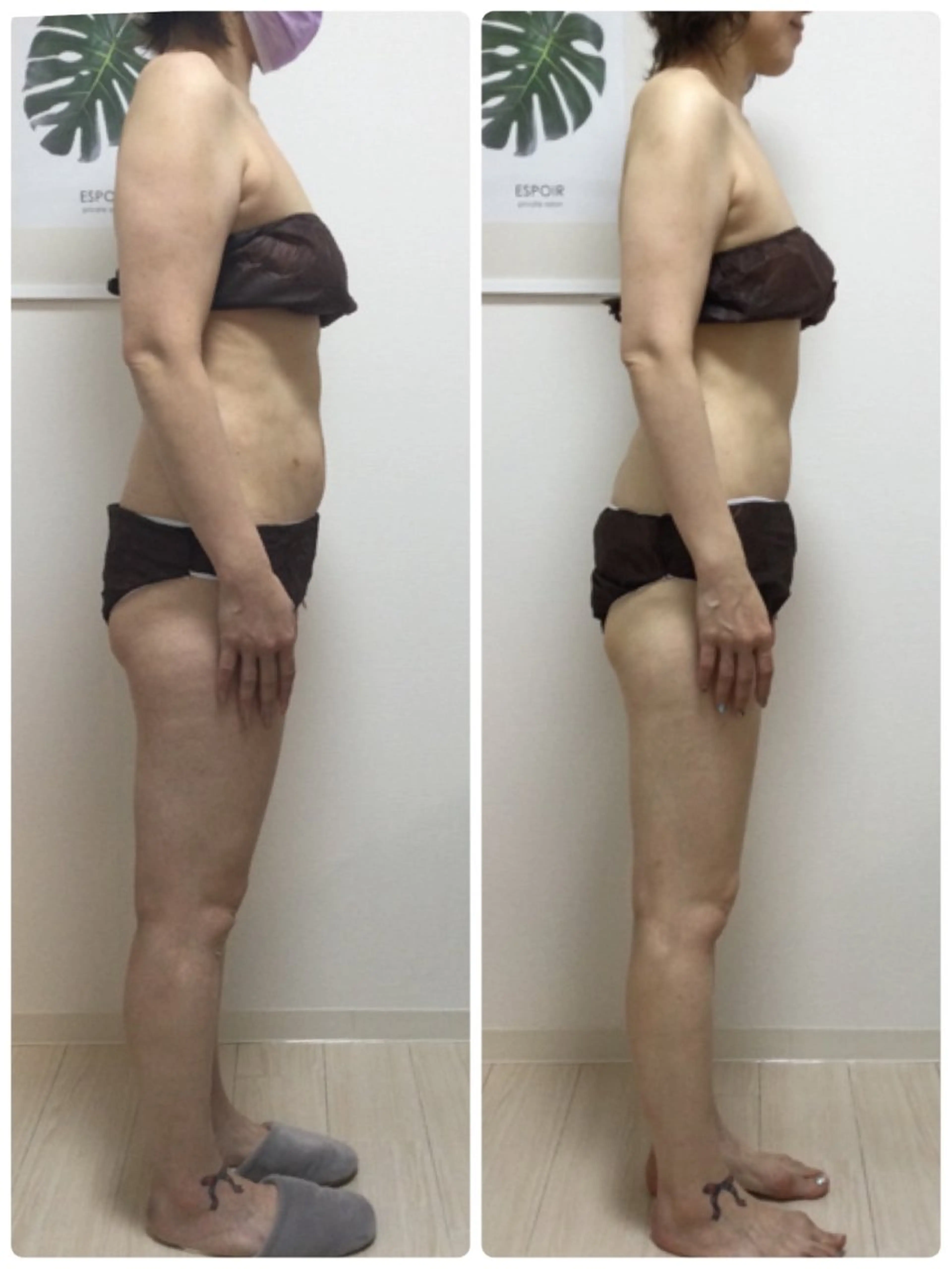 エステ リラク ESPOIR エスポワールのエステ・リラクイメージ