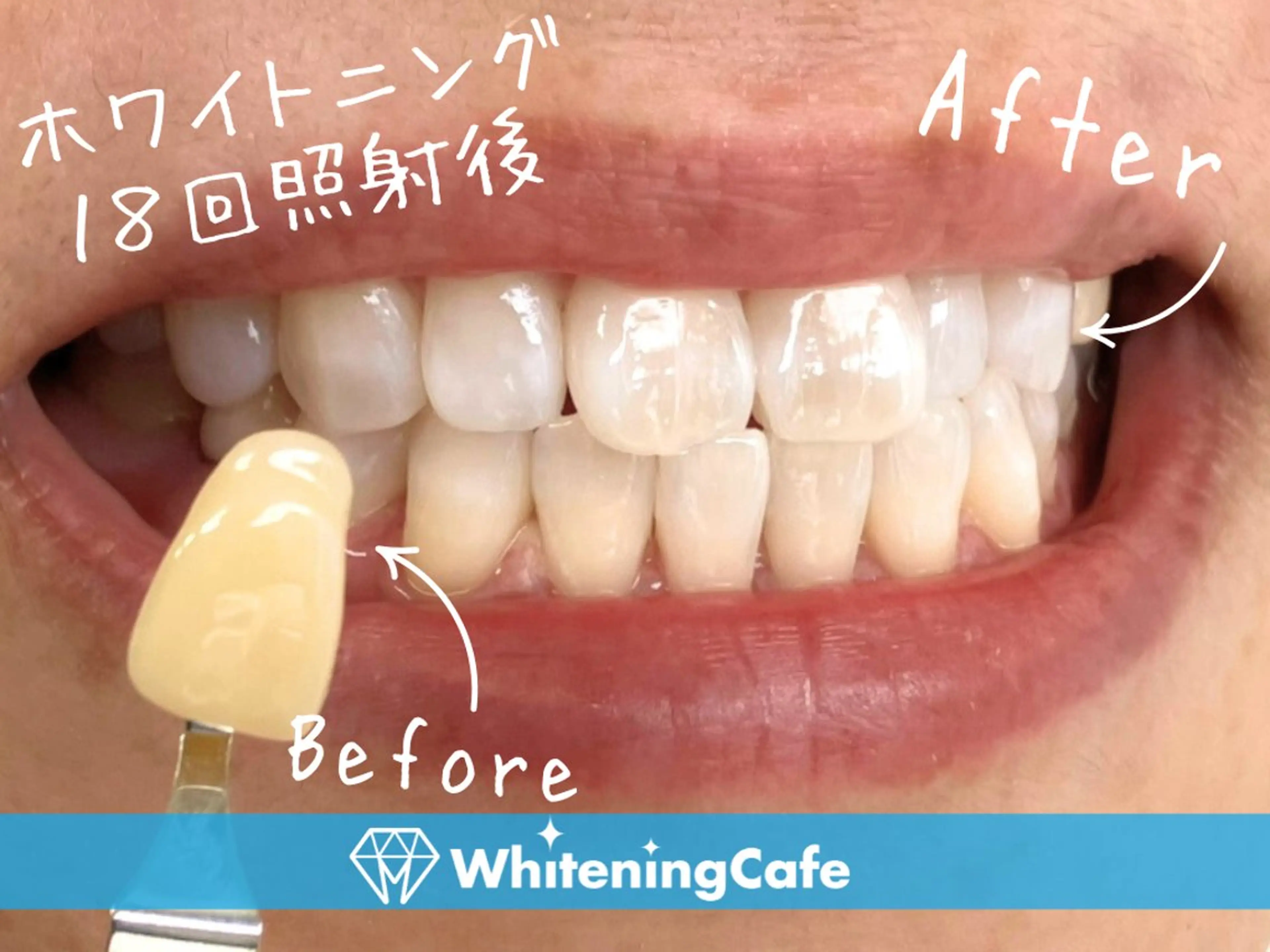 ホワイトニングカフェ徳島沖浜店所属・ホワイトニングカフェ 徳島沖浜店のエステ・リラクイメージ