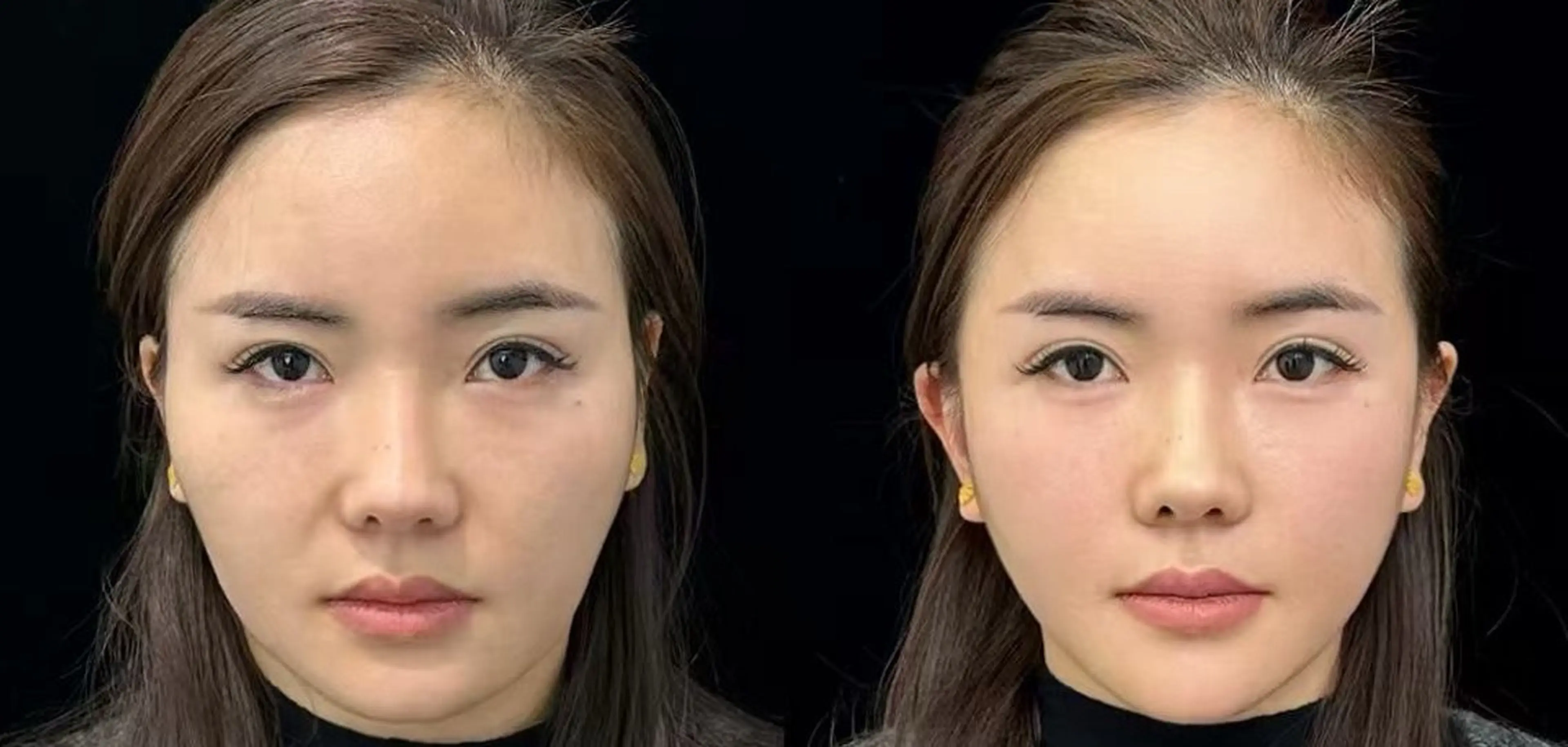 ネイル エステ aliaハイフ&水光ジェットサロン所属・aliaハーブ水光店 エステティシャン募集のエステ・リラクイメージ