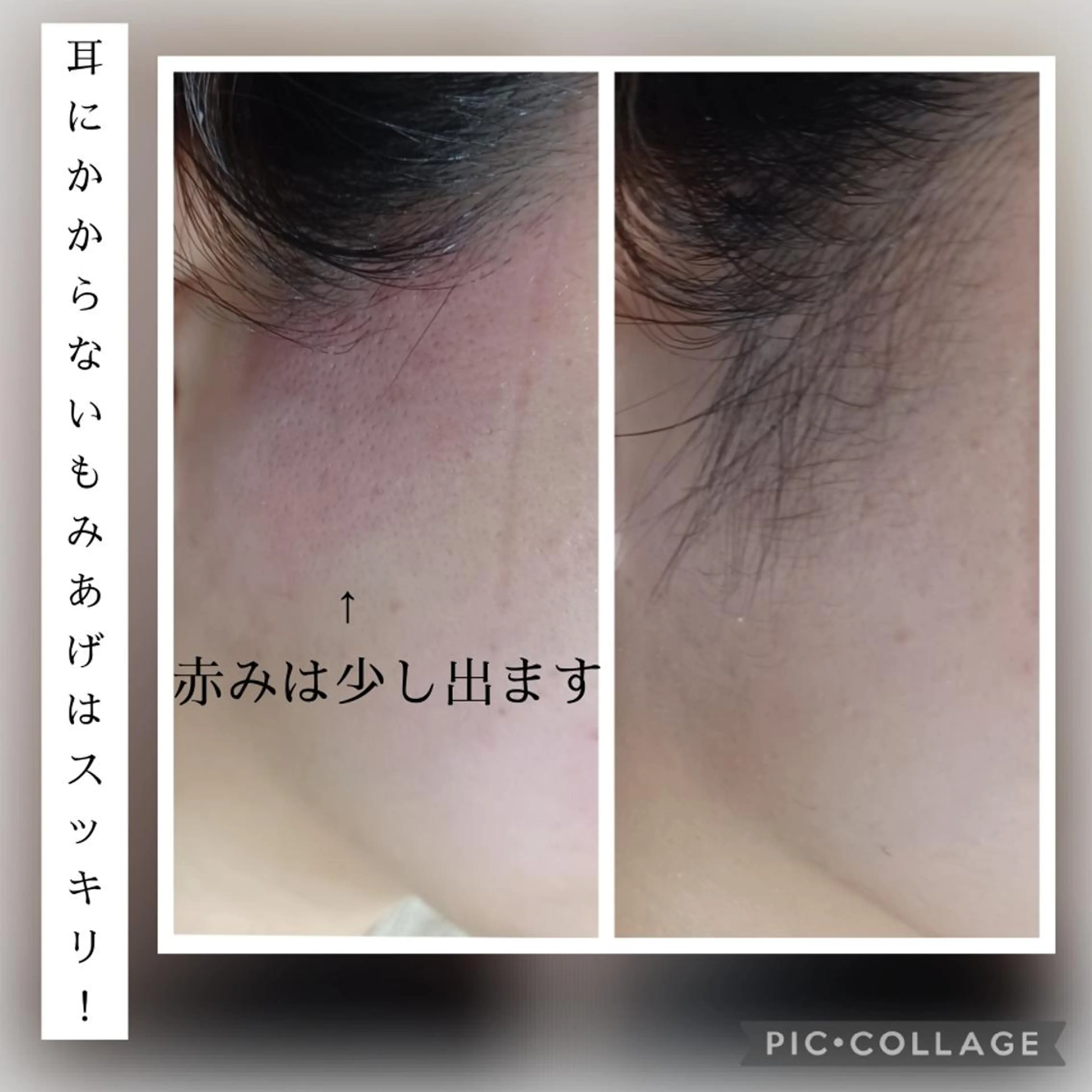 【女性】もみあげの写真