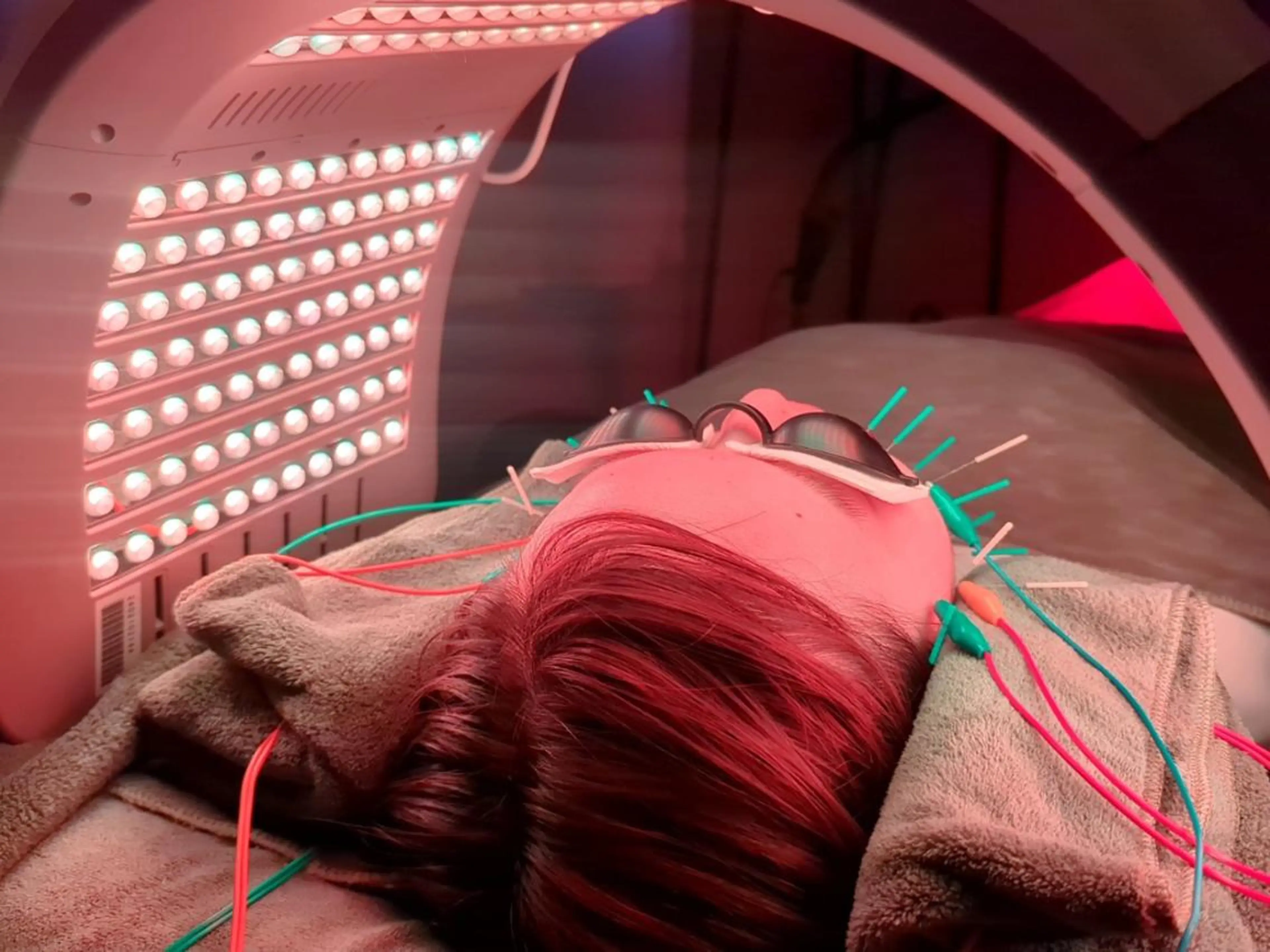 美容とカラダの鍼灸 サロン やなけんのエステ・リラクイメージ