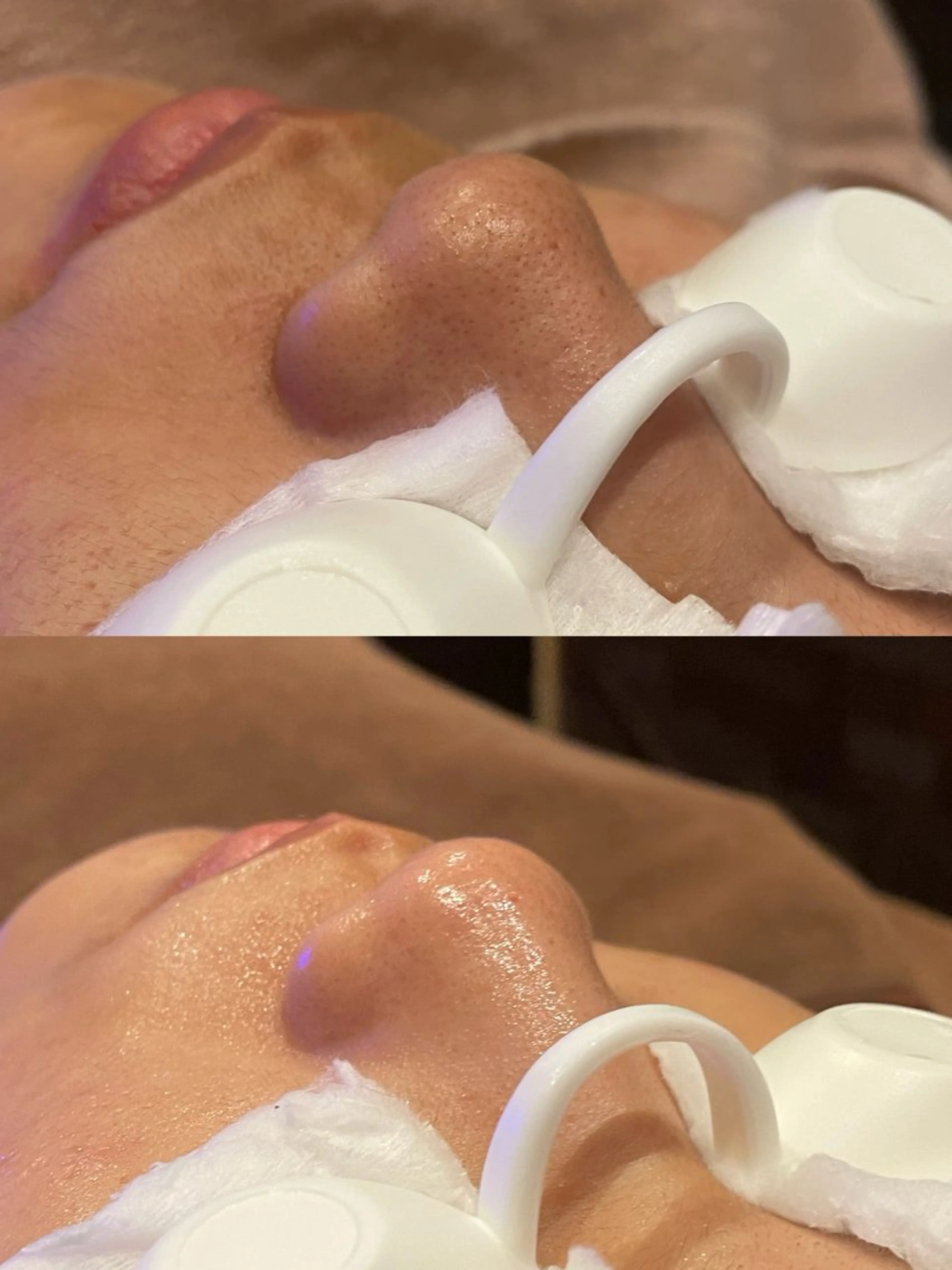 脱毛 Salon  LUMINA所属・真栄平 美咲のエステ・リラクイメージ