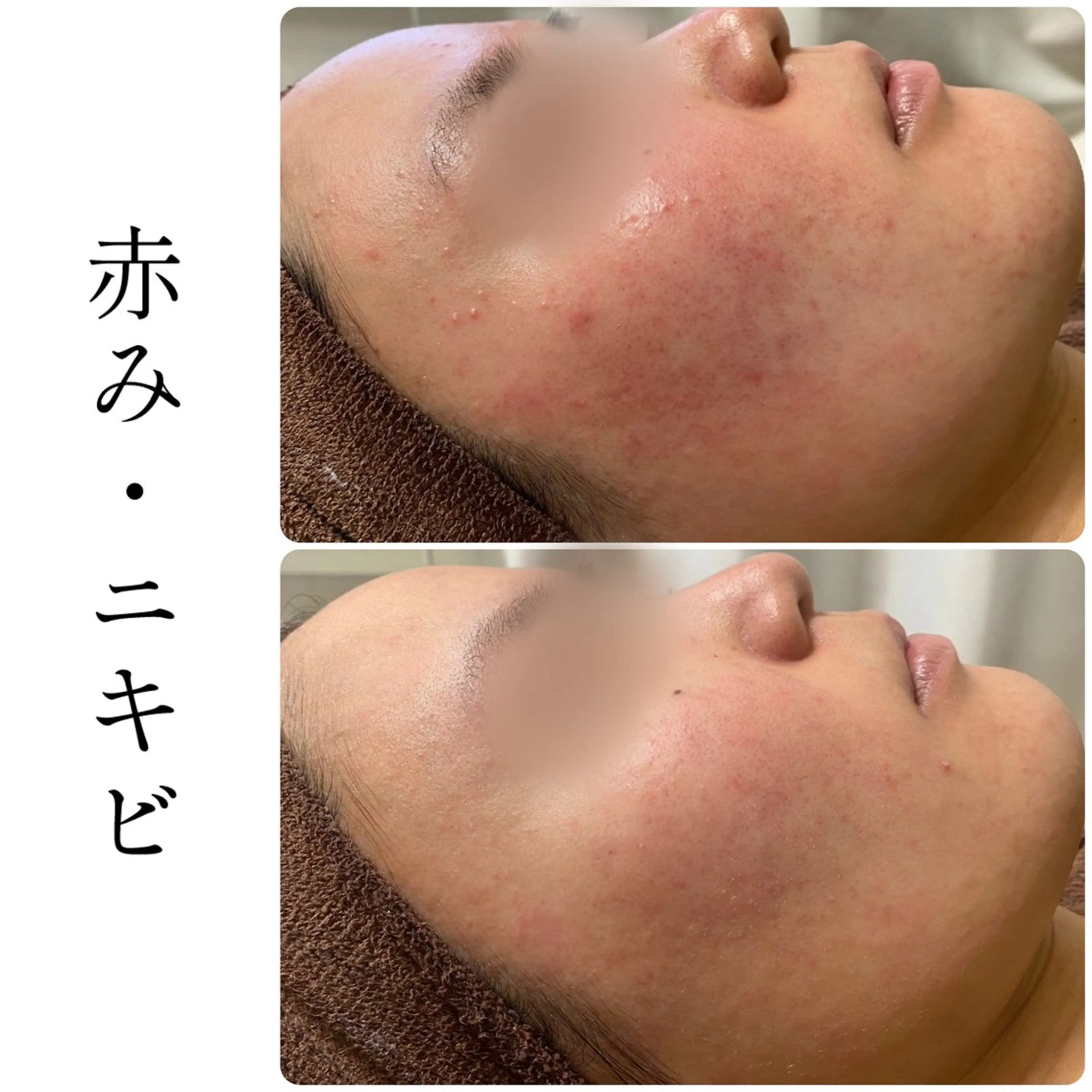 エステ ハーブピーリング専門 BIOEL横浜のエステ・リラクイメージ