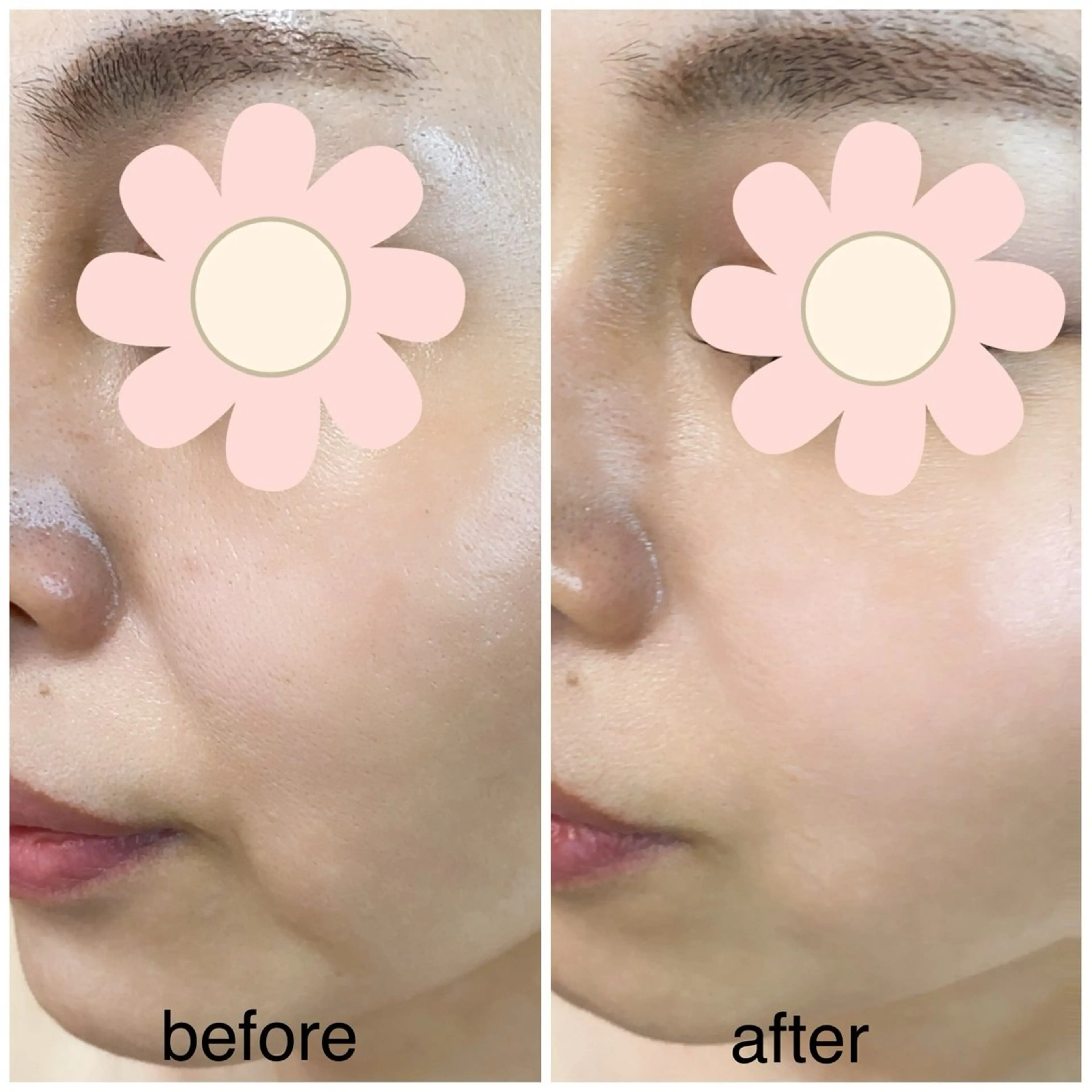 『フェイスコントアリフト』✨️深部に働きかけ、フェイスラインをスッキリ整えるリフト特化フェイシャル！の写真