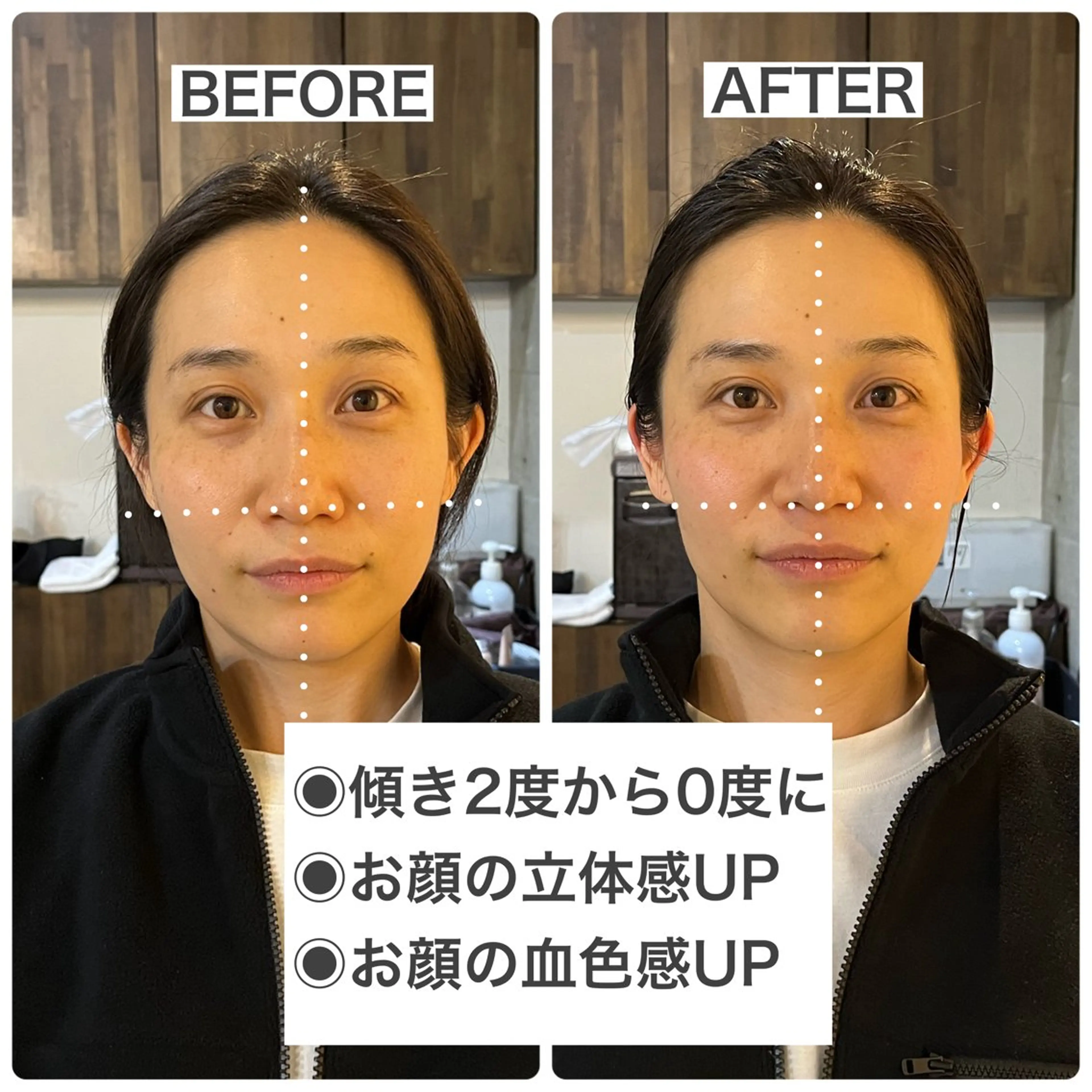 【メンテナンス】骨格補正ヘッドスパ＋Xトリートメントの写真