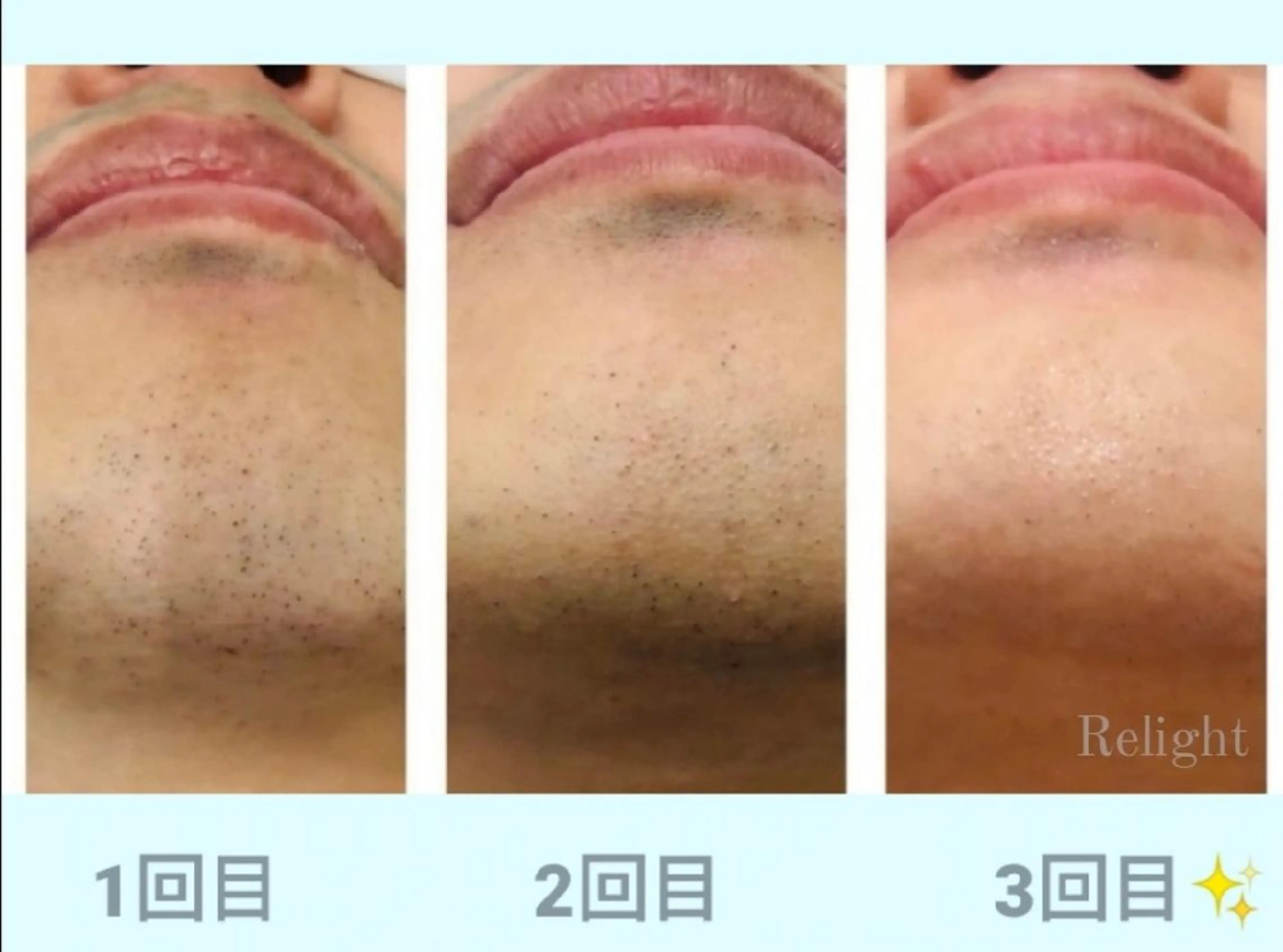 メンズ ロング Relight あかりのエステ・リラクイメージ